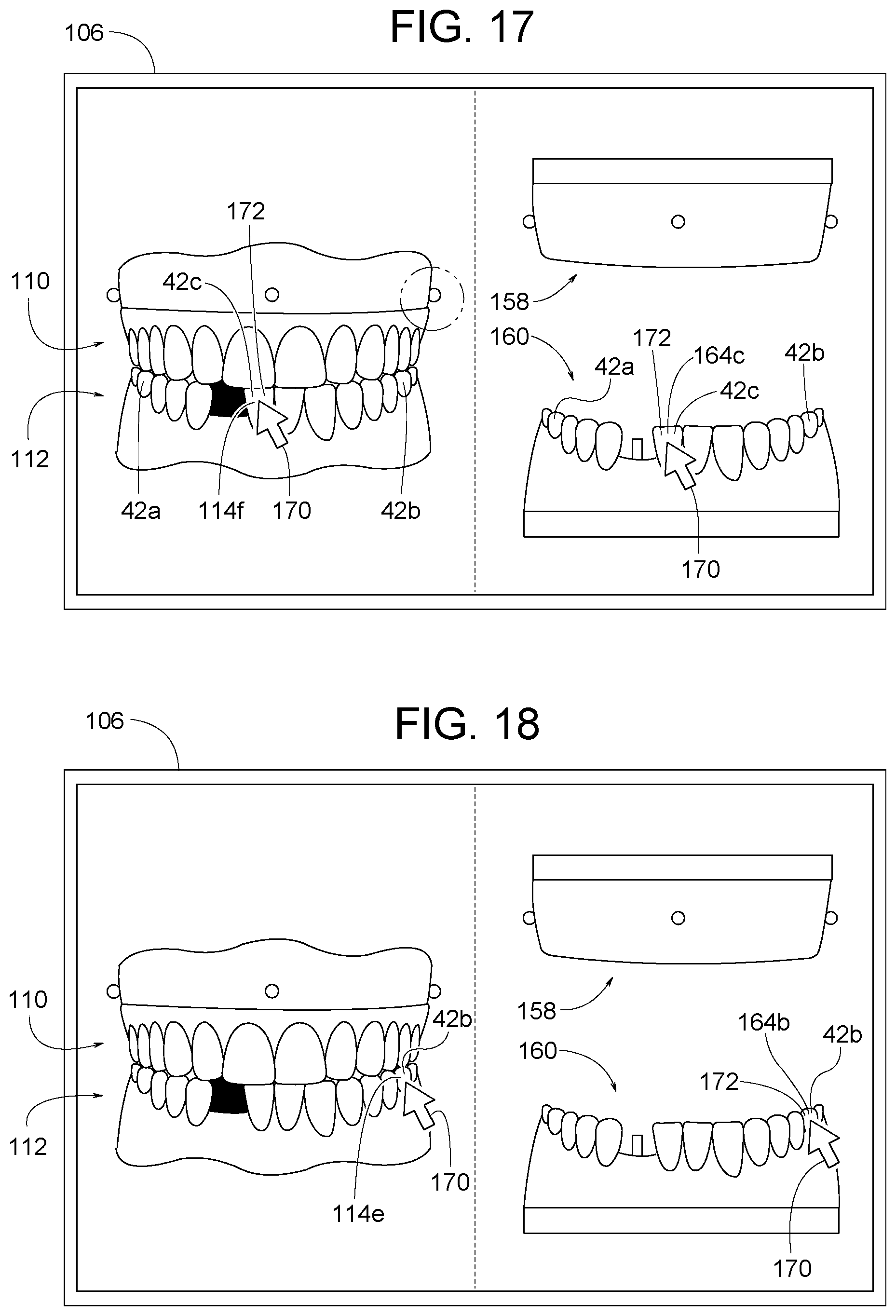 Patent US12307656 Figure 9 – Computer assisted dental methods for analyzing jaws