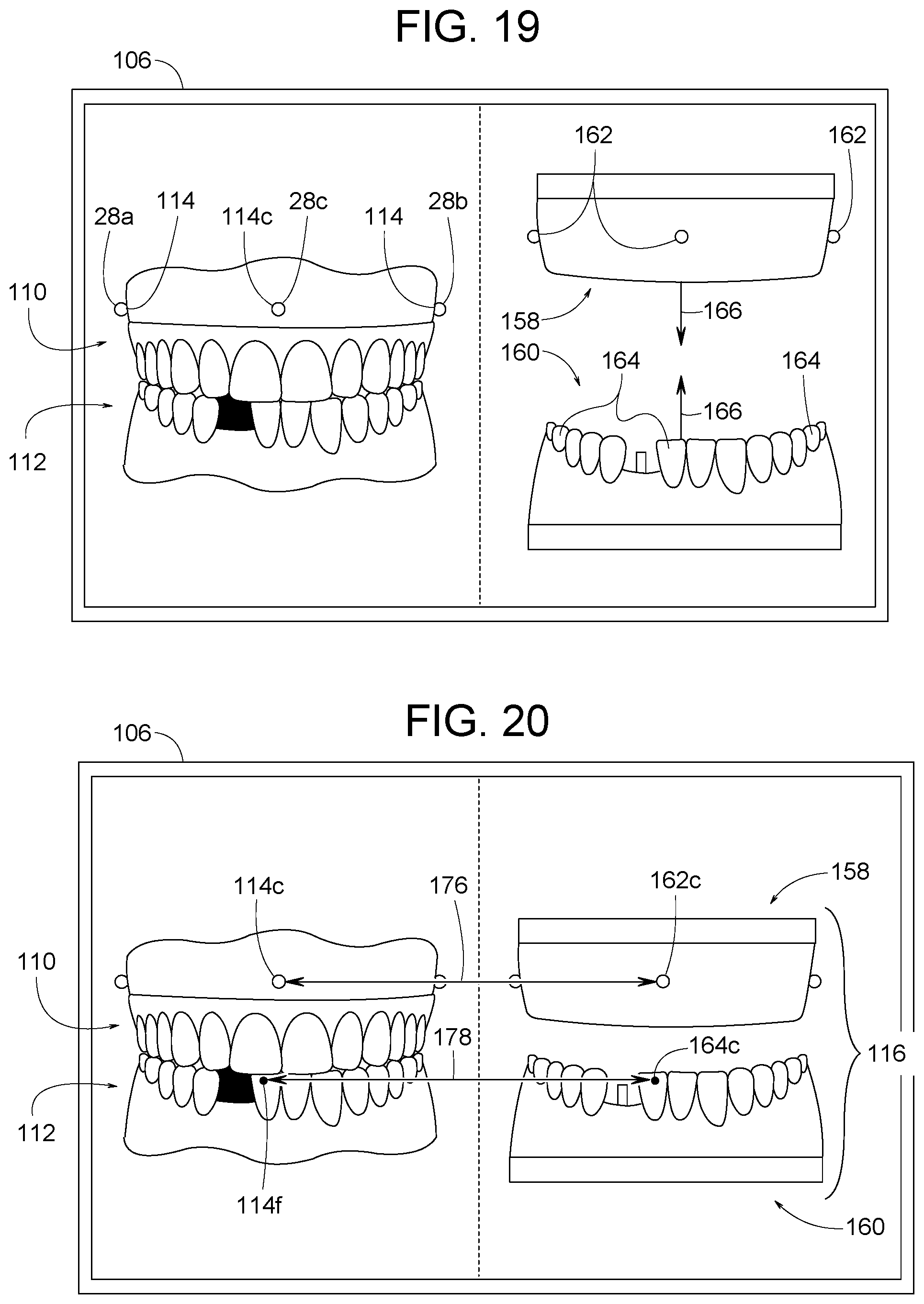 Patent US12307656 Figure 10 – Computer assisted dental methods for analyzing jaws