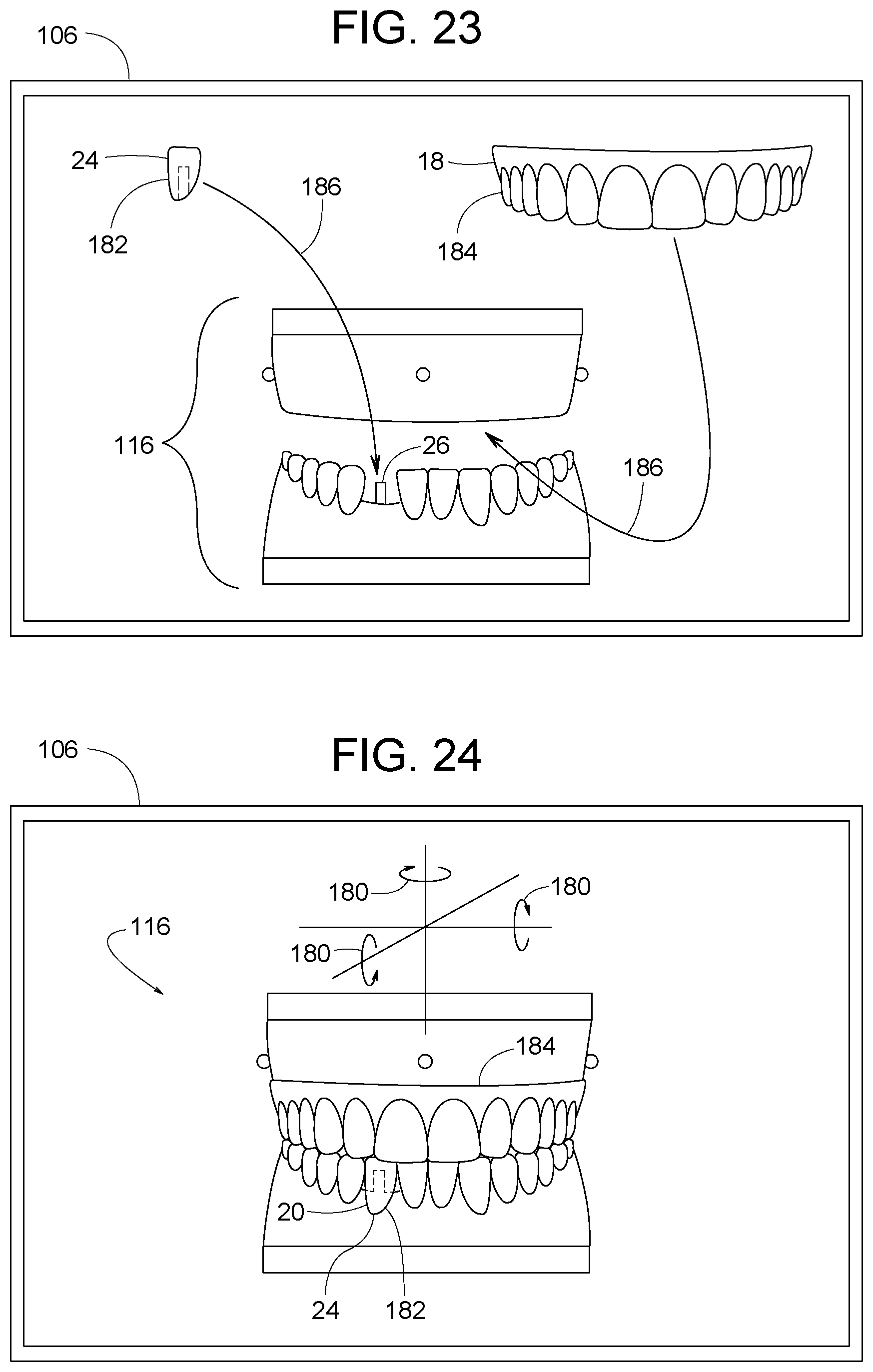 Patent US12307656 Figure 12 – Computer assisted dental methods for analyzing jaws