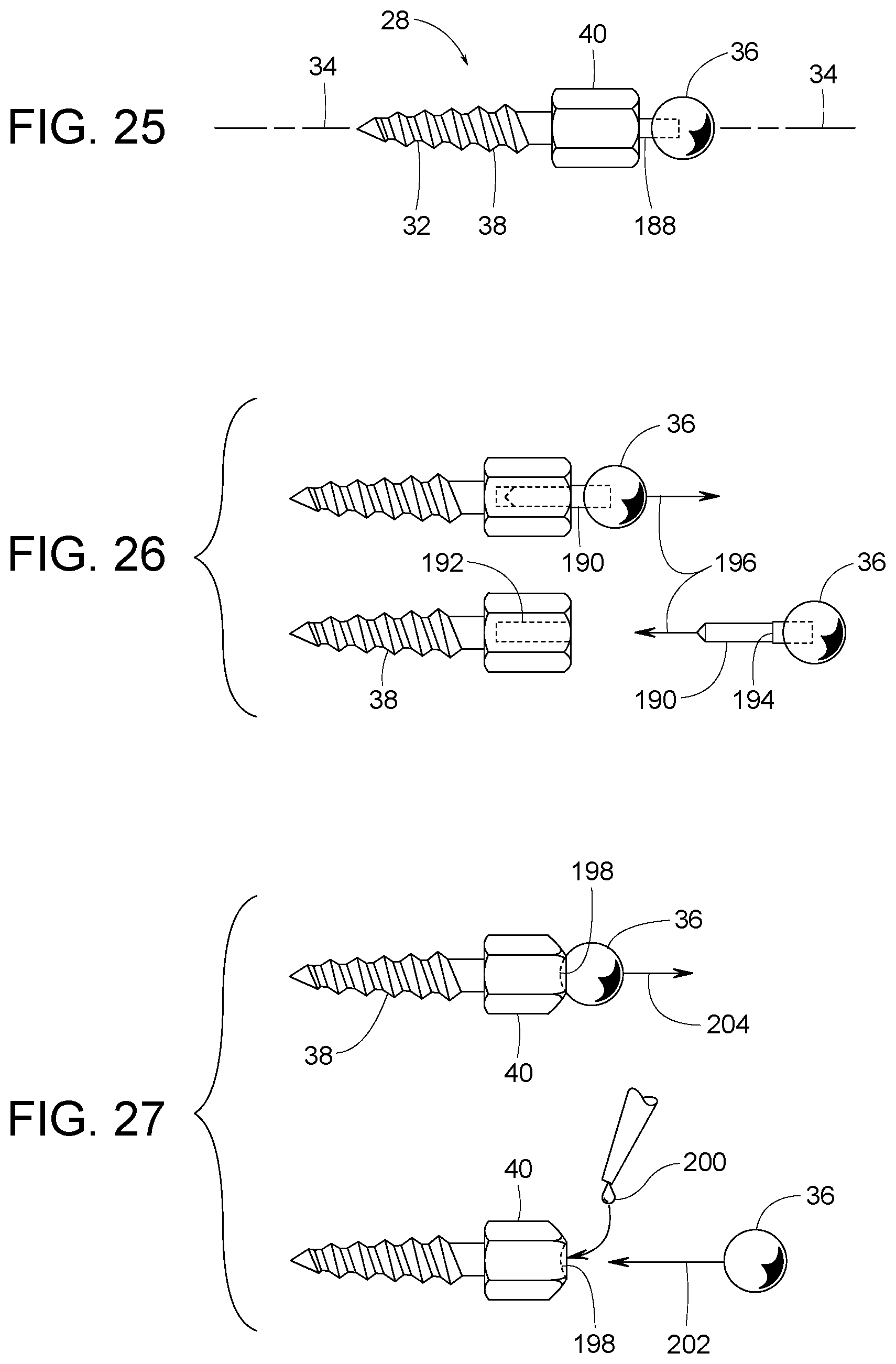 Patent US12307656 Figure 13 – Computer assisted dental methods for analyzing jaws