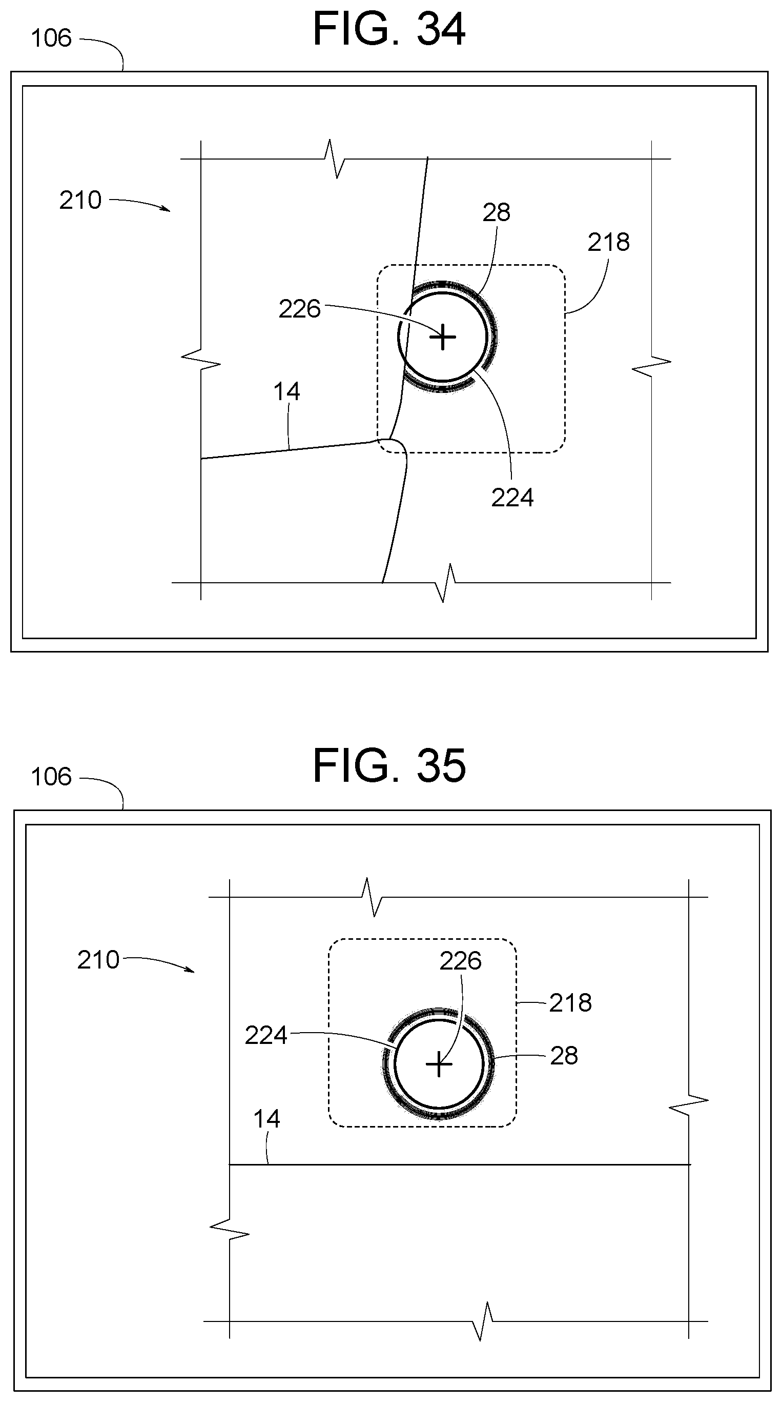 Patent US12307656 Figure 17 – Computer assisted dental methods for analyzing jaws