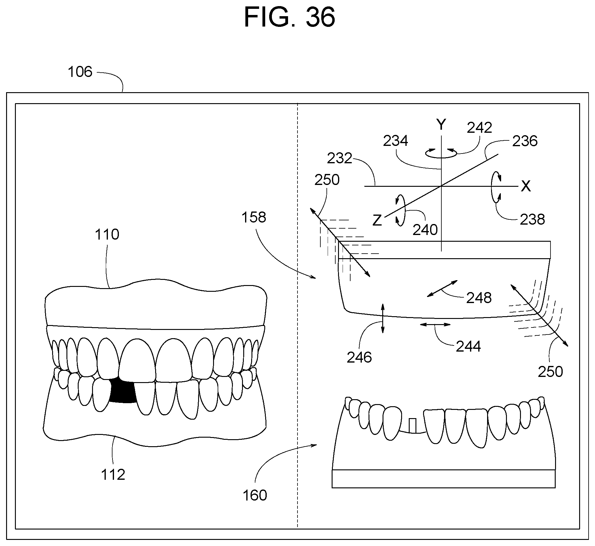 Patent US12307656 Figure 18 – Computer assisted dental methods for analyzing jaws