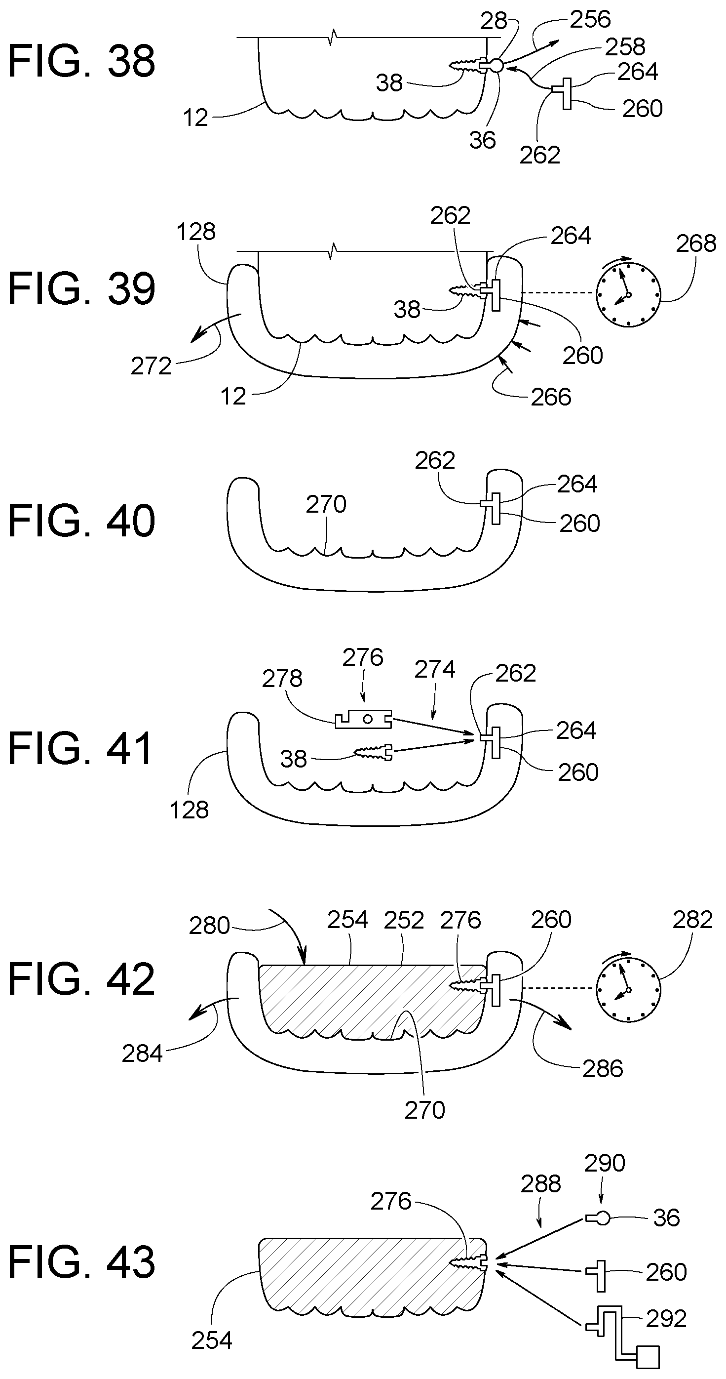 Patent US12307656 Figure 20 – Computer assisted dental methods for analyzing jaws