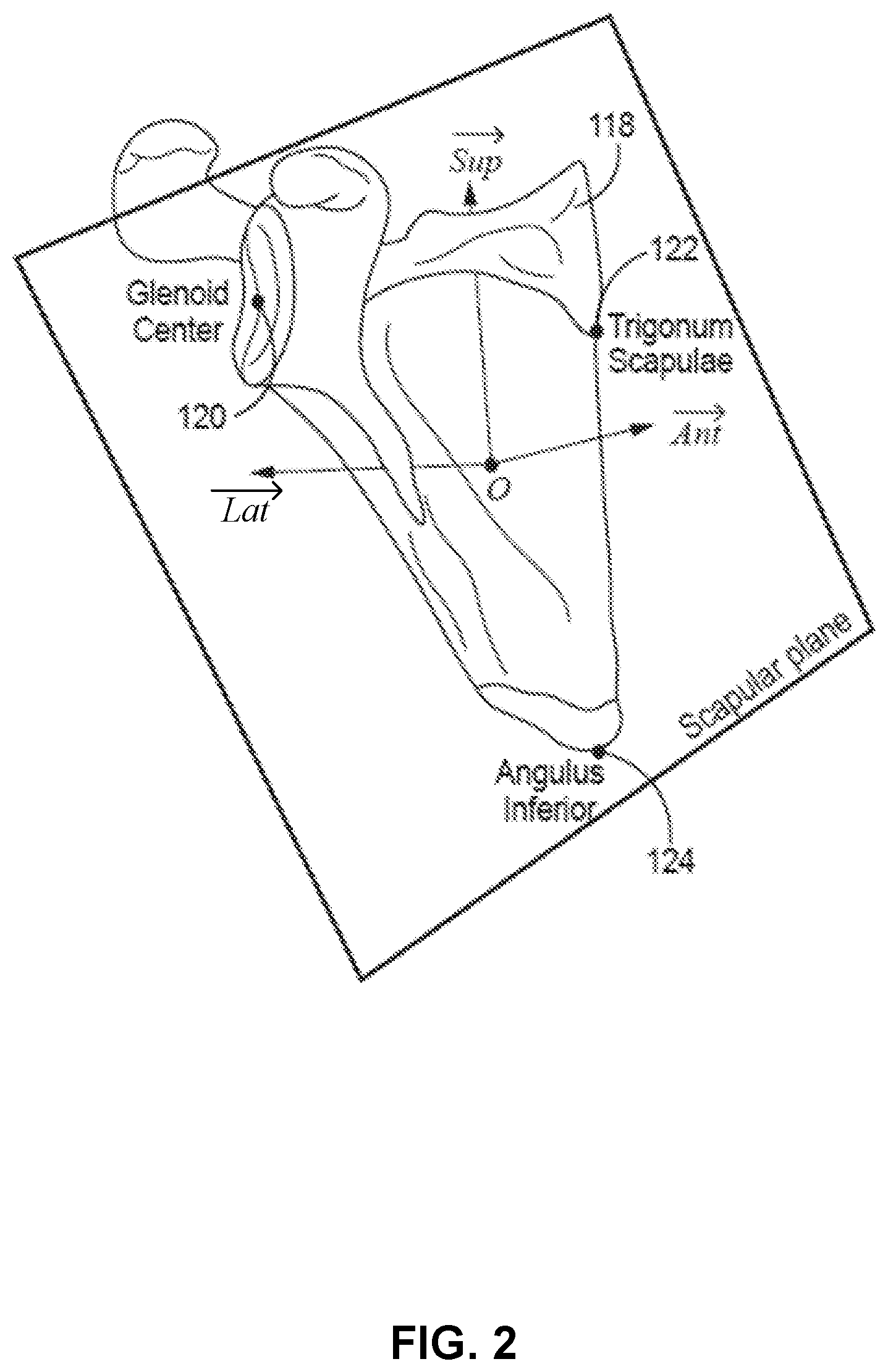 Patent US12307658 Figure 2 – Pre-morbid characterization of anatomical object using statistical shape modeling (SSM)