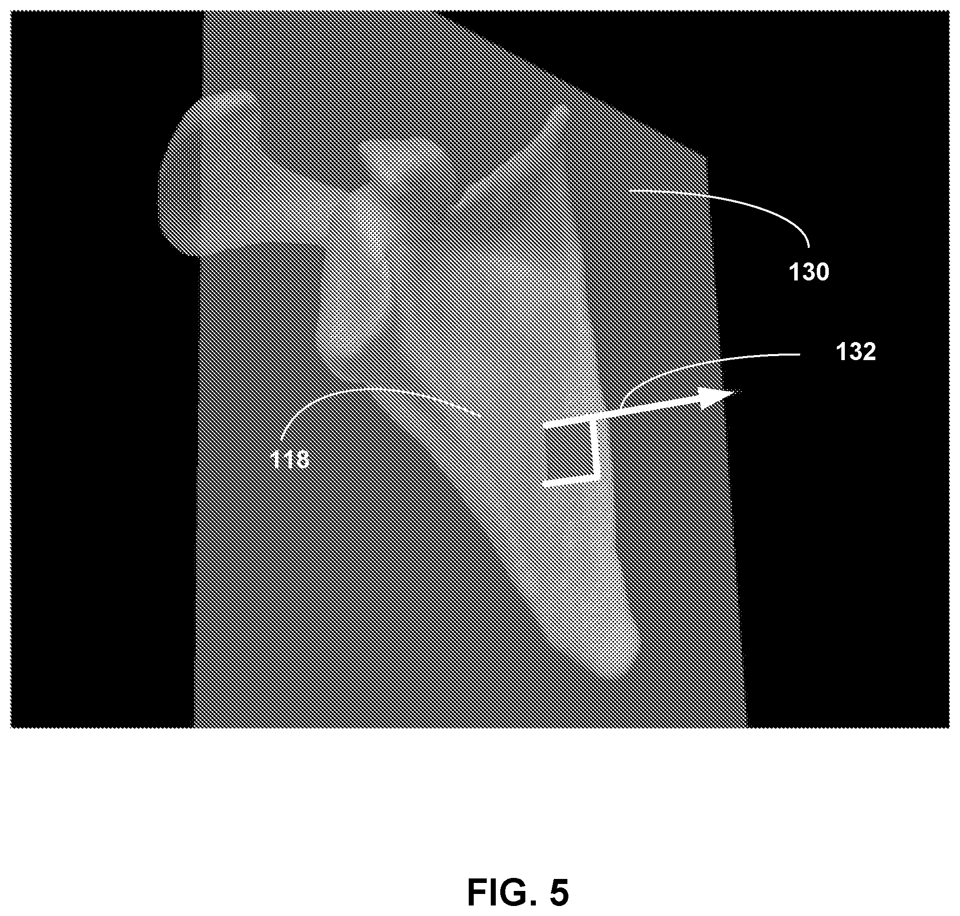 Patent US12307658 Figure 5 – Pre-morbid characterization of anatomical object using statistical shape modeling (SSM)