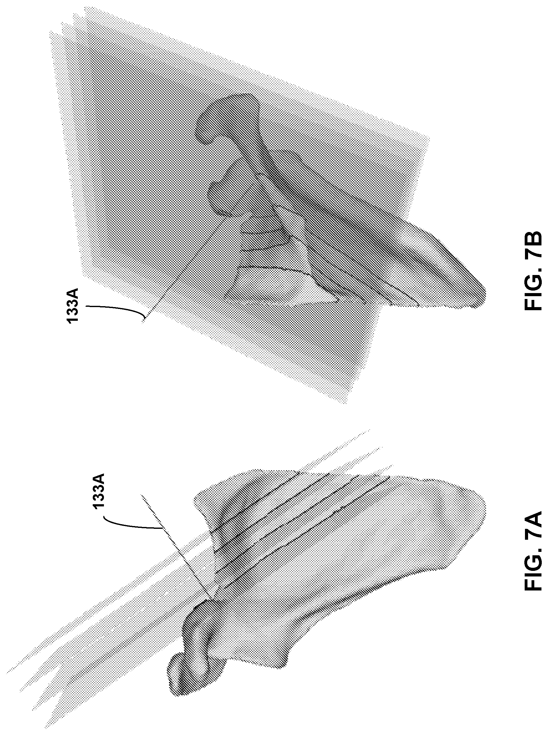 Patent US12307658 Figure 7 – Pre-morbid characterization of anatomical object using statistical shape modeling (SSM)