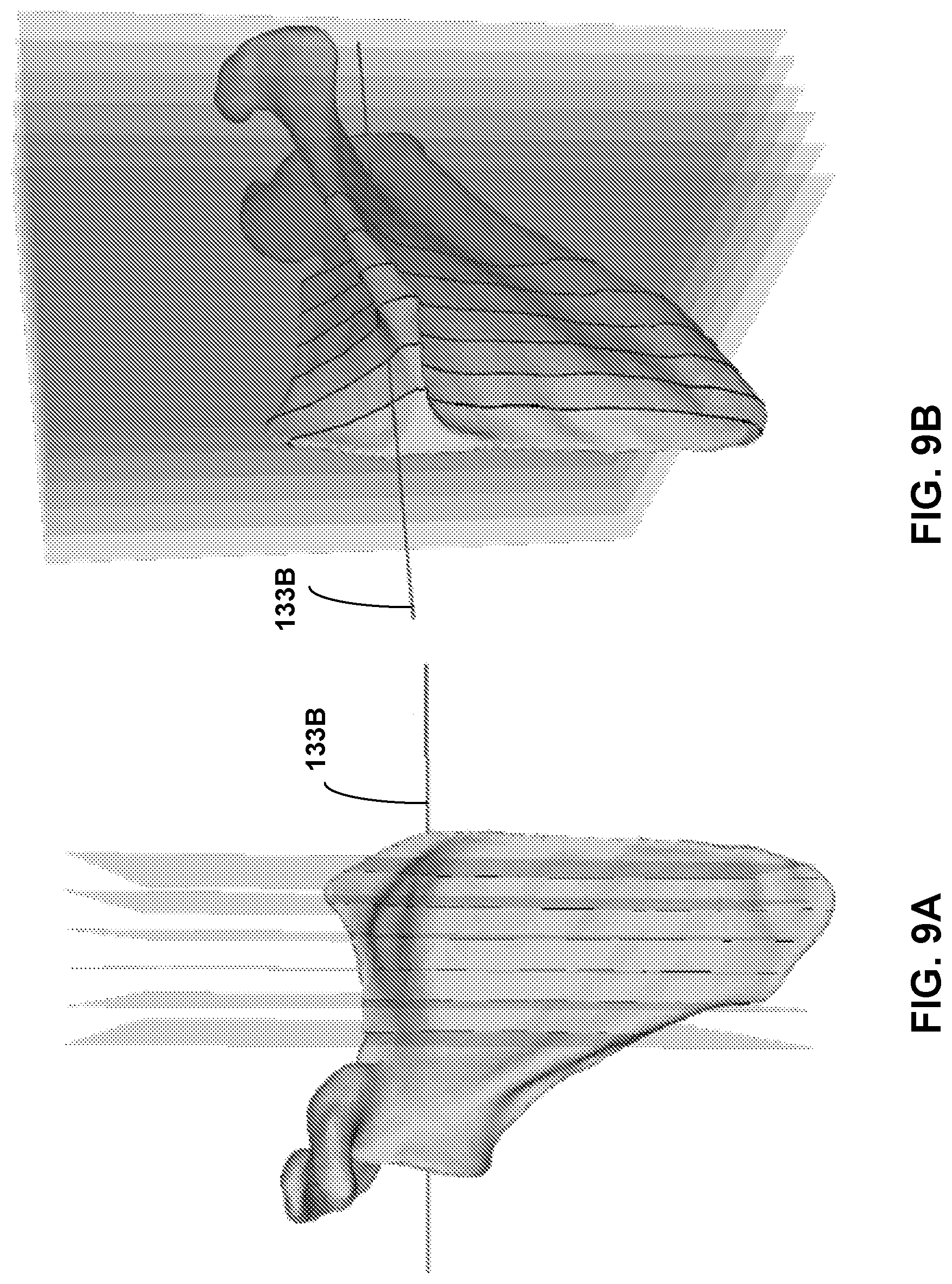 Patent US12307658 Figure 9 – Pre-morbid characterization of anatomical object using statistical shape modeling (SSM)
