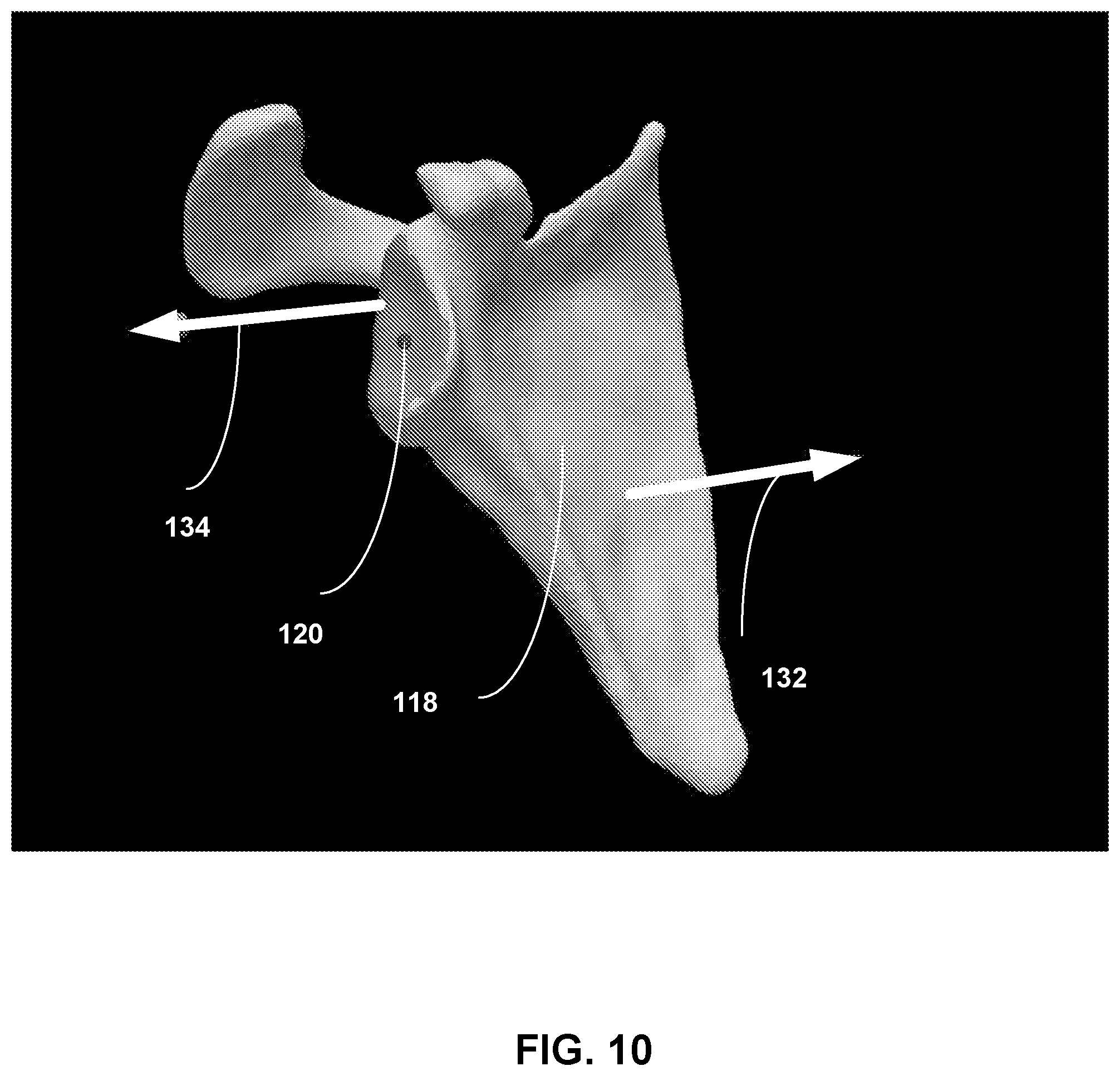 Patent US12307658 Figure 10 – Pre-morbid characterization of anatomical object using statistical shape modeling (SSM)