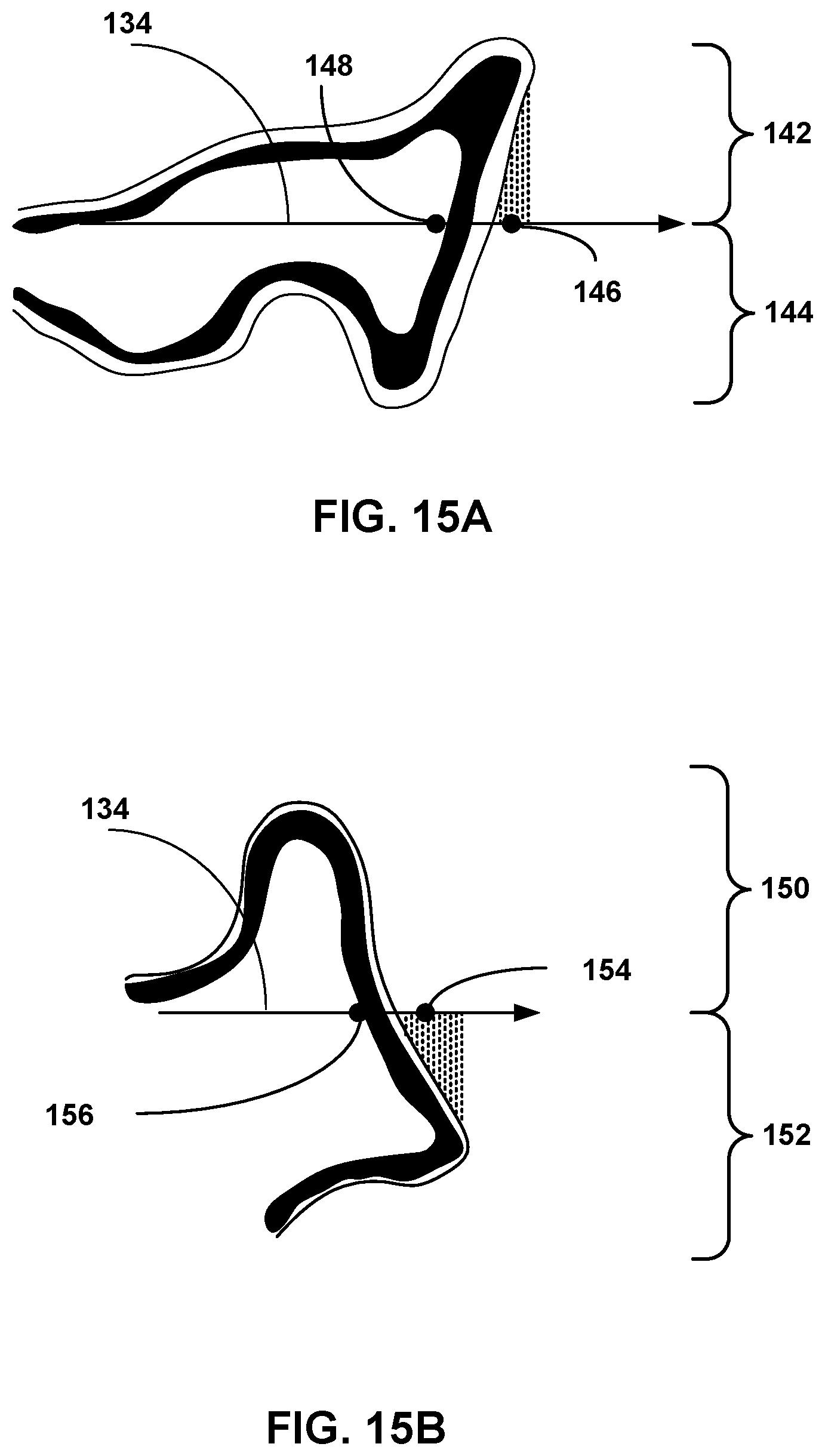 Patent US12307658 Figure 15 – Pre-morbid characterization of anatomical object using statistical shape modeling (SSM)