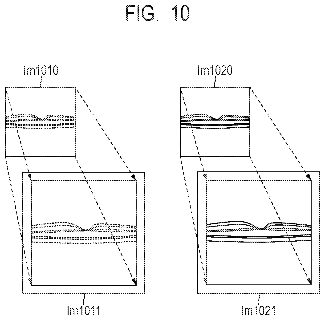 Patent US12307659 Figure 9 – Medical image processing apparatus, medical image processing method and computer-readable storage medium