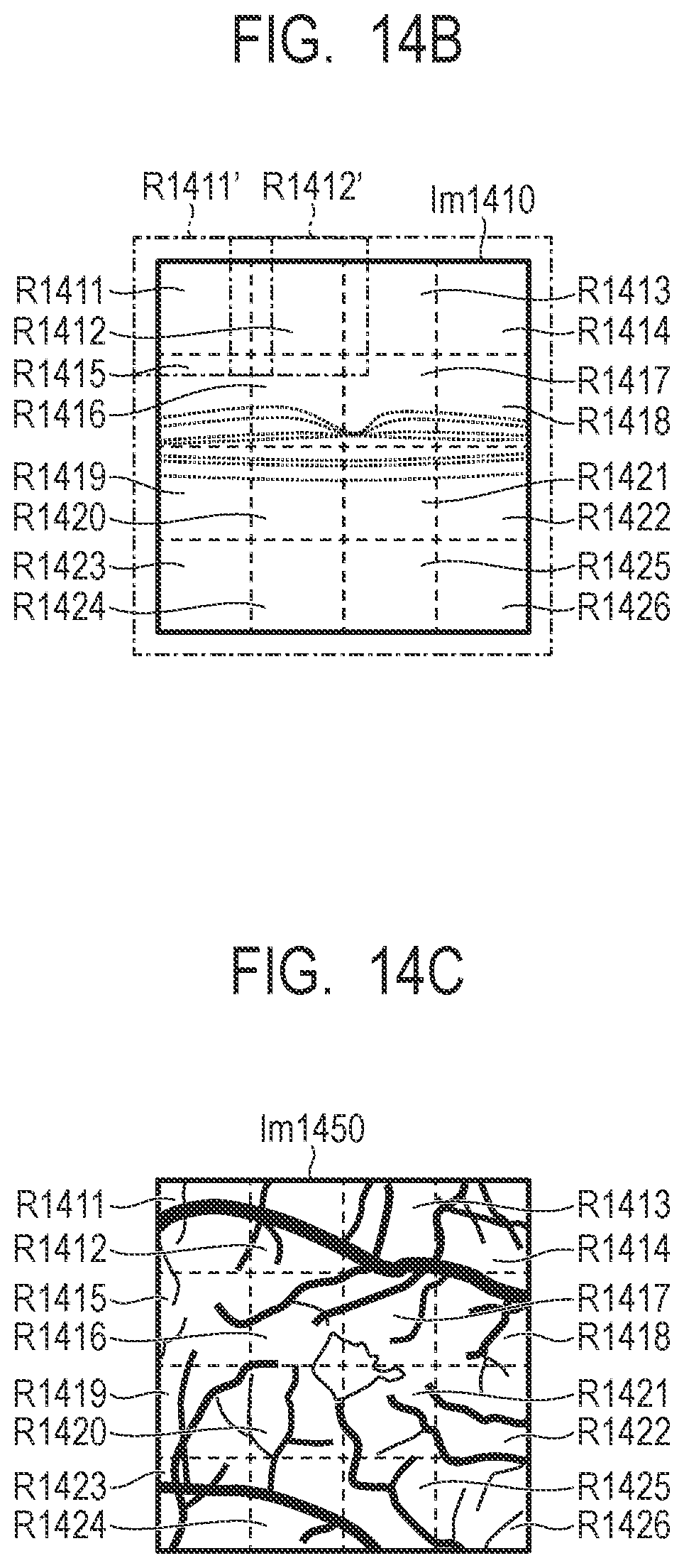 Patent US12307659 Figure 12 – Medical image processing apparatus, medical image processing method and computer-readable storage medium