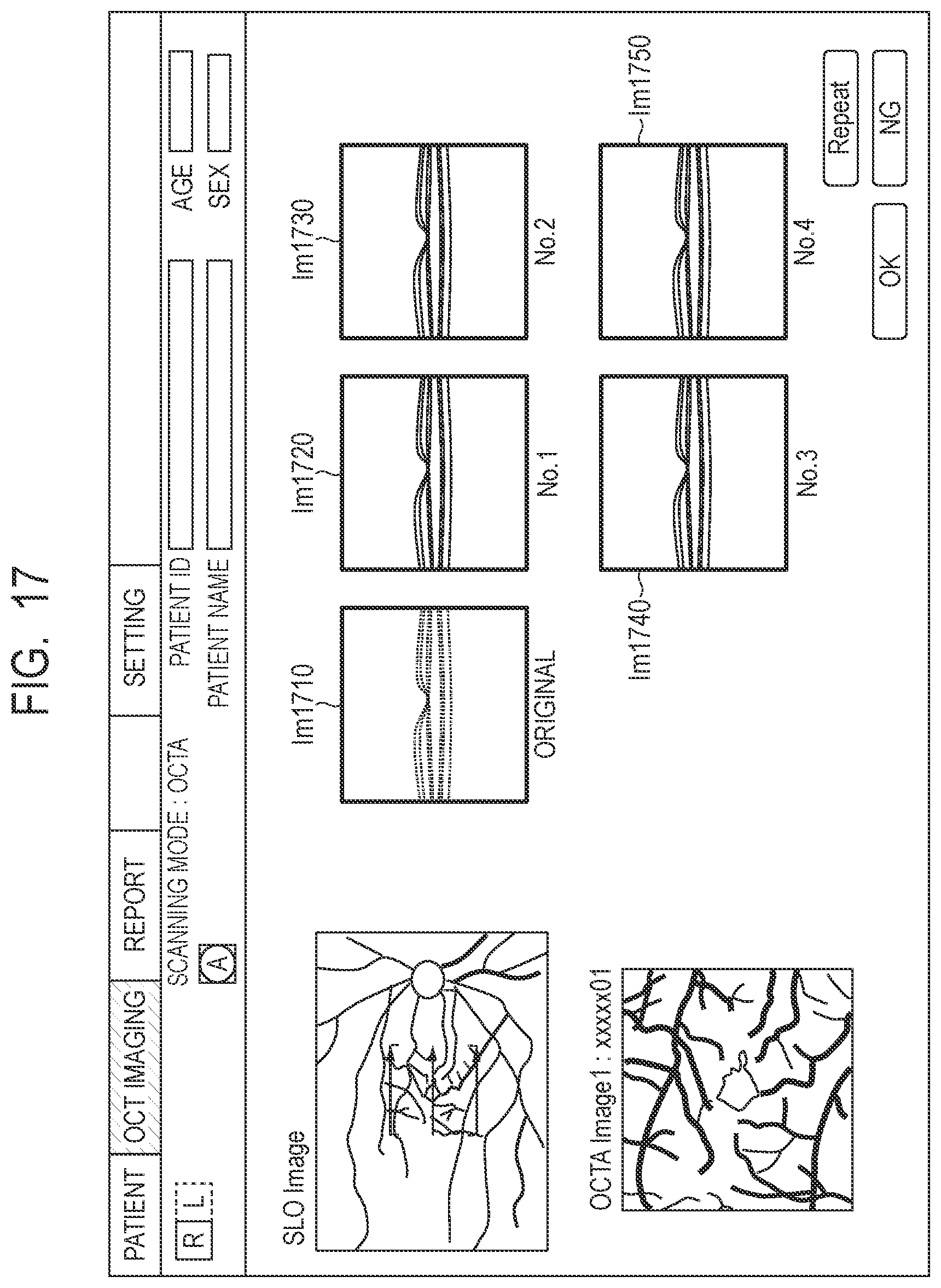 Patent US12307659 Figure 15 – Medical image processing apparatus, medical image processing method and computer-readable storage medium