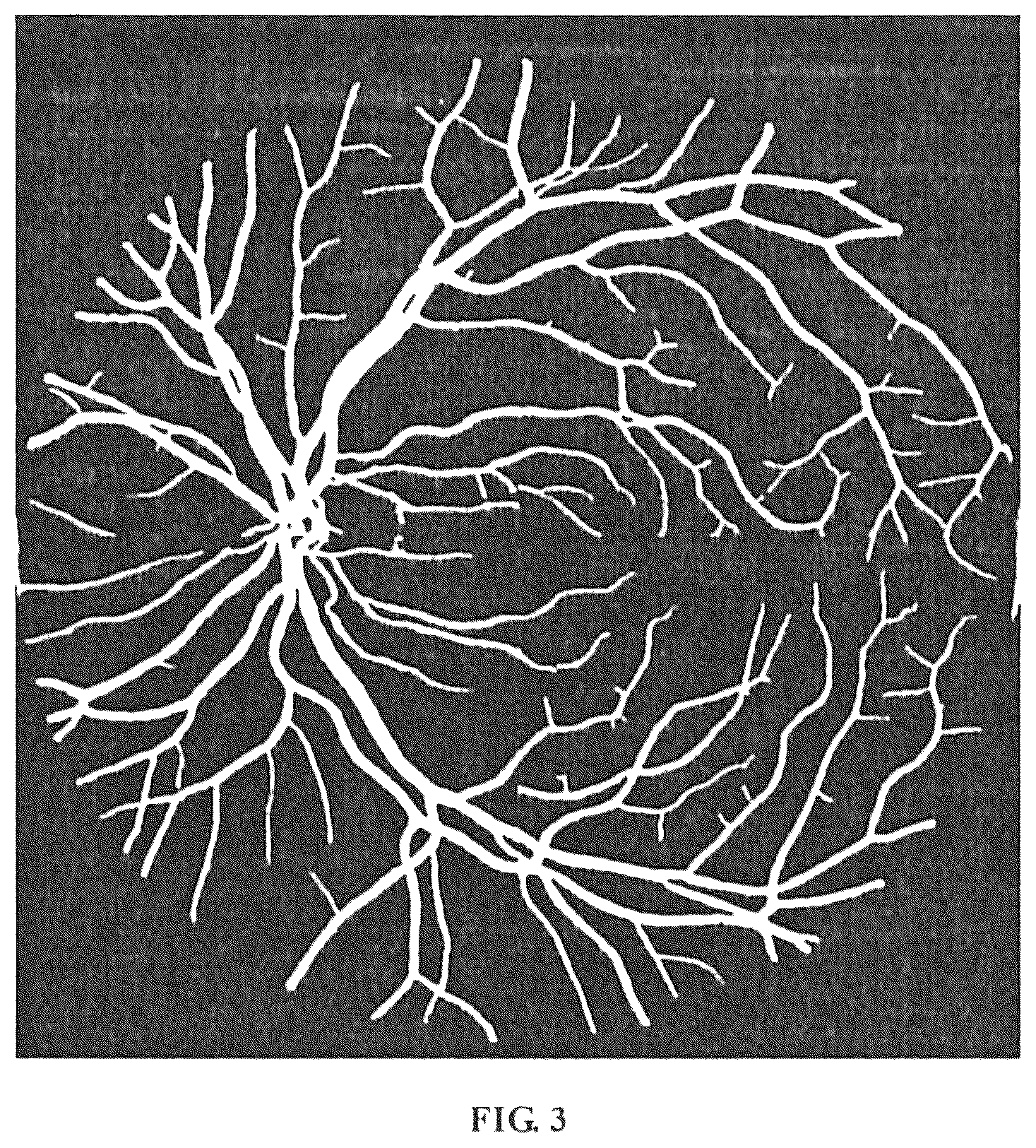 Patent US12307663 Figure 3 – Method, device and apparatus for differentiating arteries and veins of retinal vessels