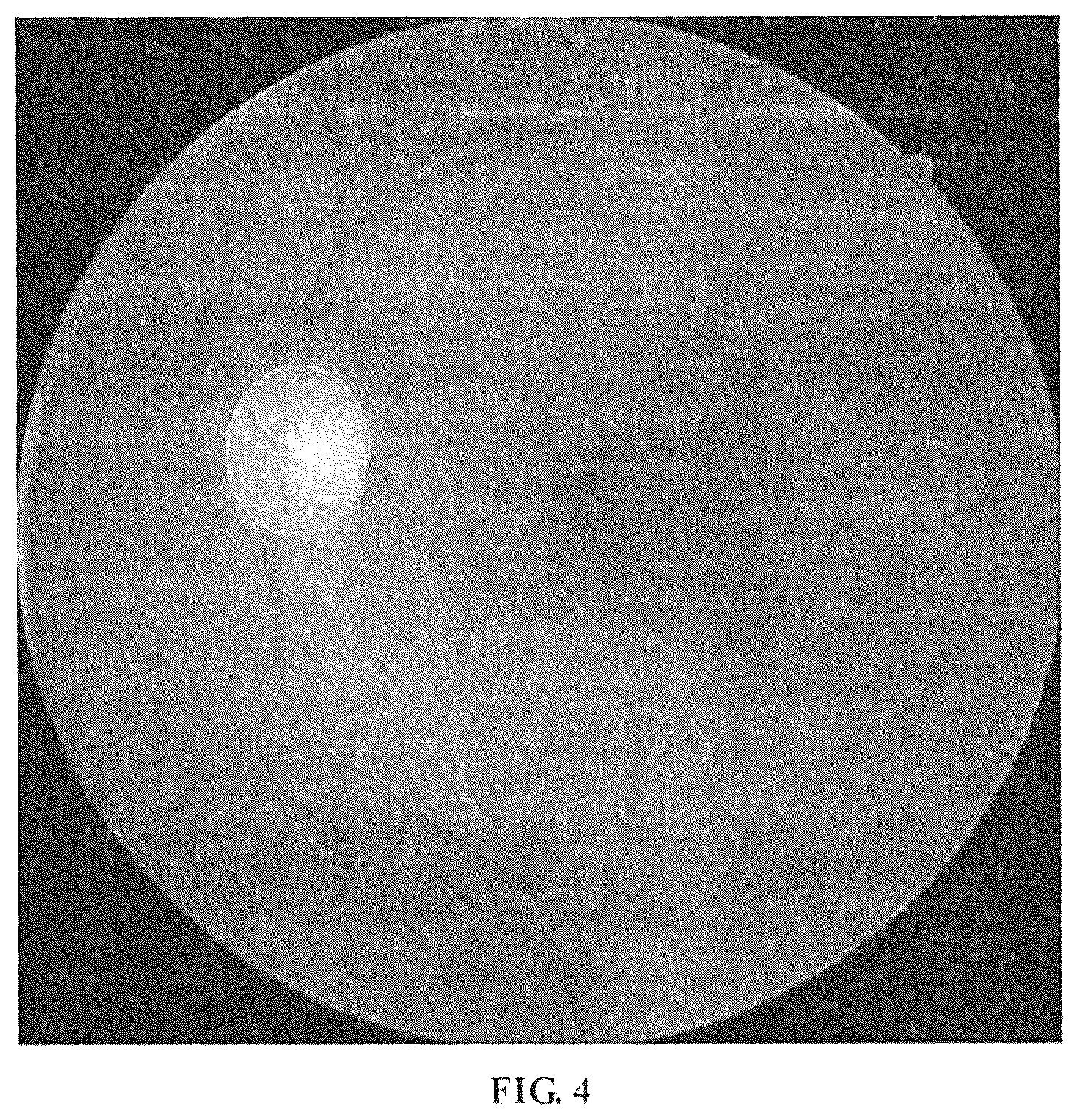 Patent US12307663 Figure 4 – Method, device and apparatus for differentiating arteries and veins of retinal vessels