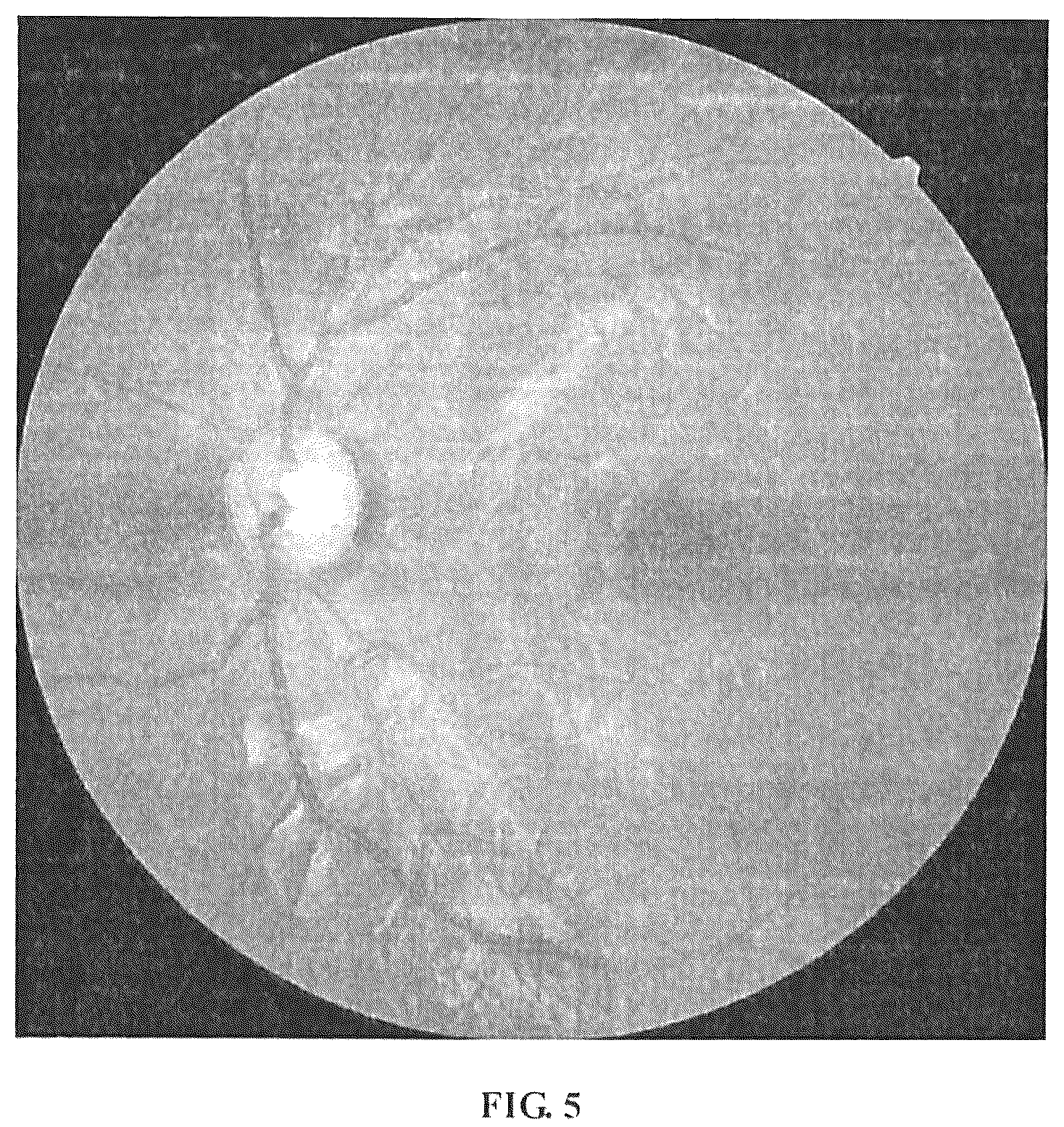 Patent US12307663 Figure 5 – Method, device and apparatus for differentiating arteries and veins of retinal vessels