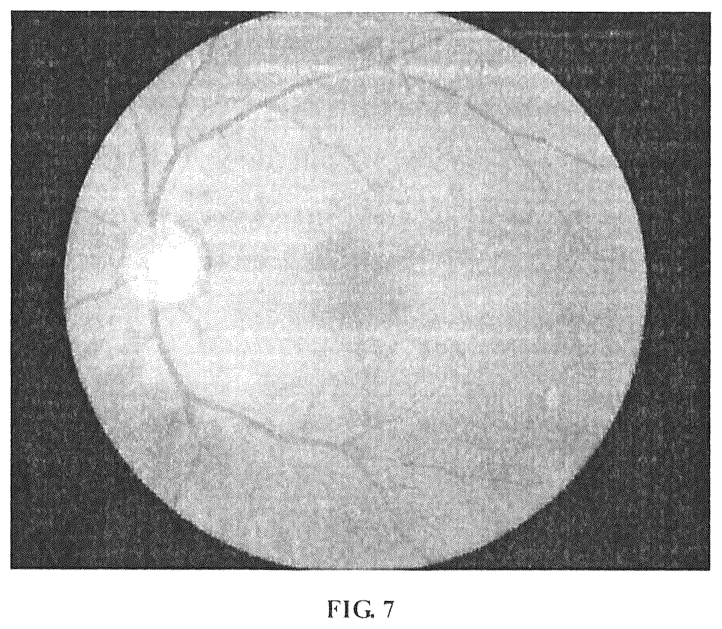 Patent US12307663 Figure 7 – Method, device and apparatus for differentiating arteries and veins of retinal vessels