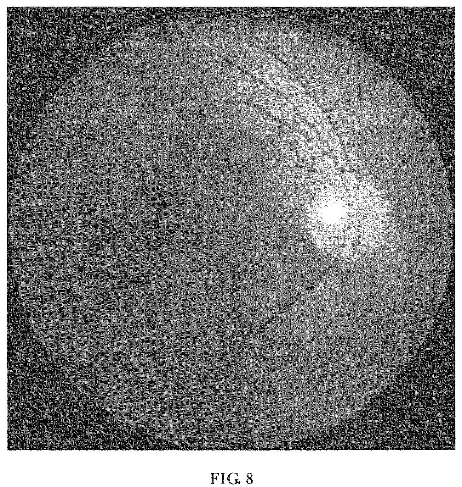 Patent US12307663 Figure 8 – Method, device and apparatus for differentiating arteries and veins of retinal vessels