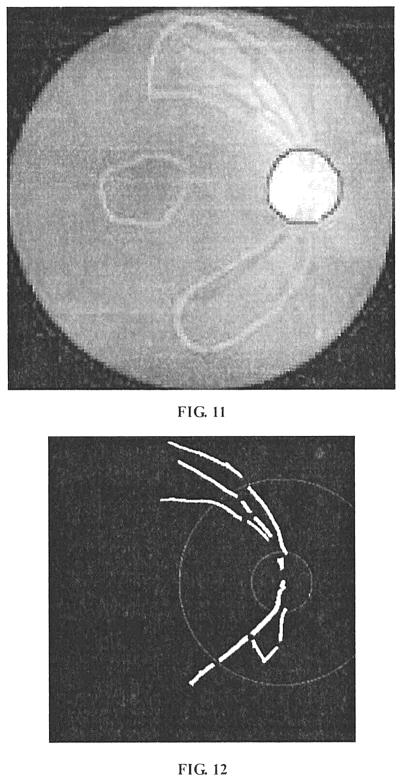 Patent US12307663 Figure 10 – Method, device and apparatus for differentiating arteries and veins of retinal vessels