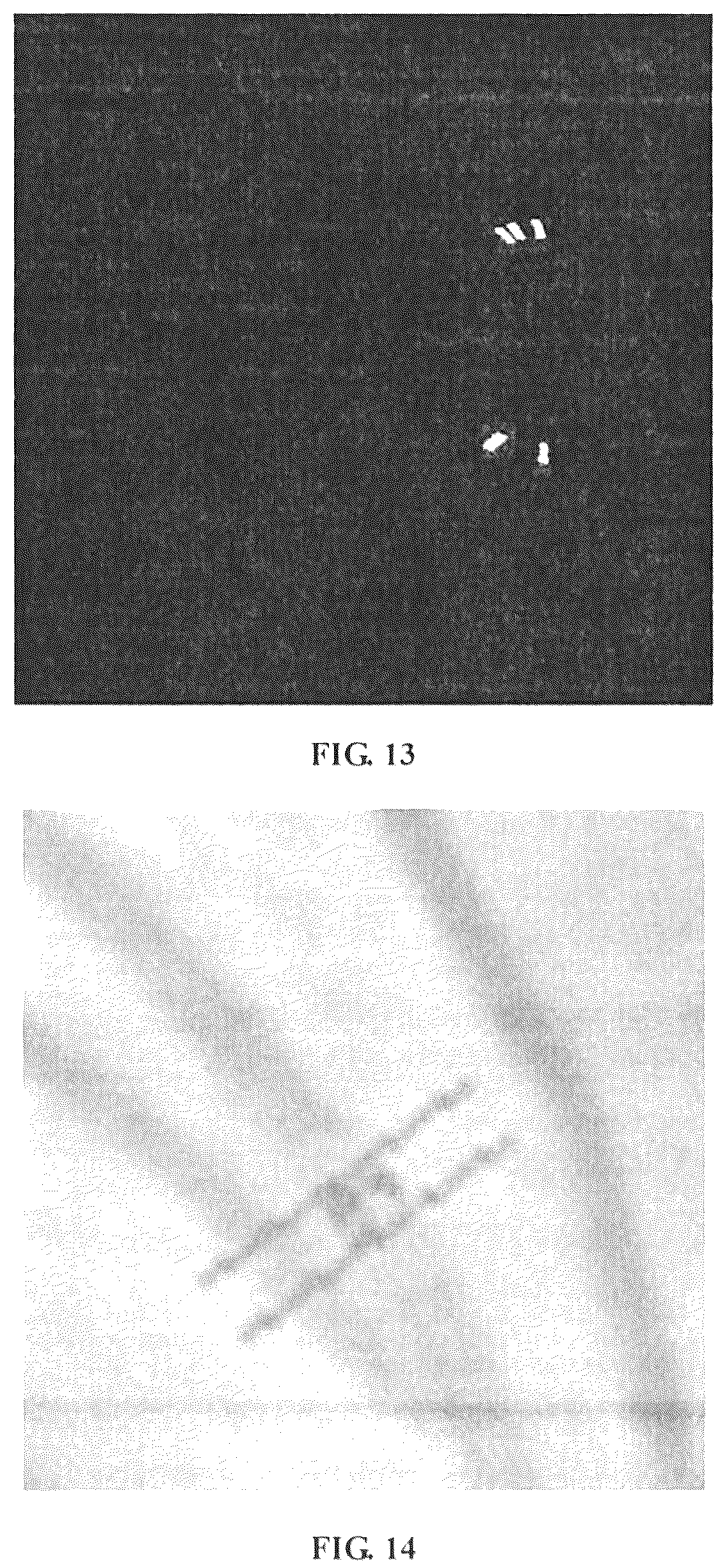 Patent US12307663 Figure 11 – Method, device and apparatus for differentiating arteries and veins of retinal vessels