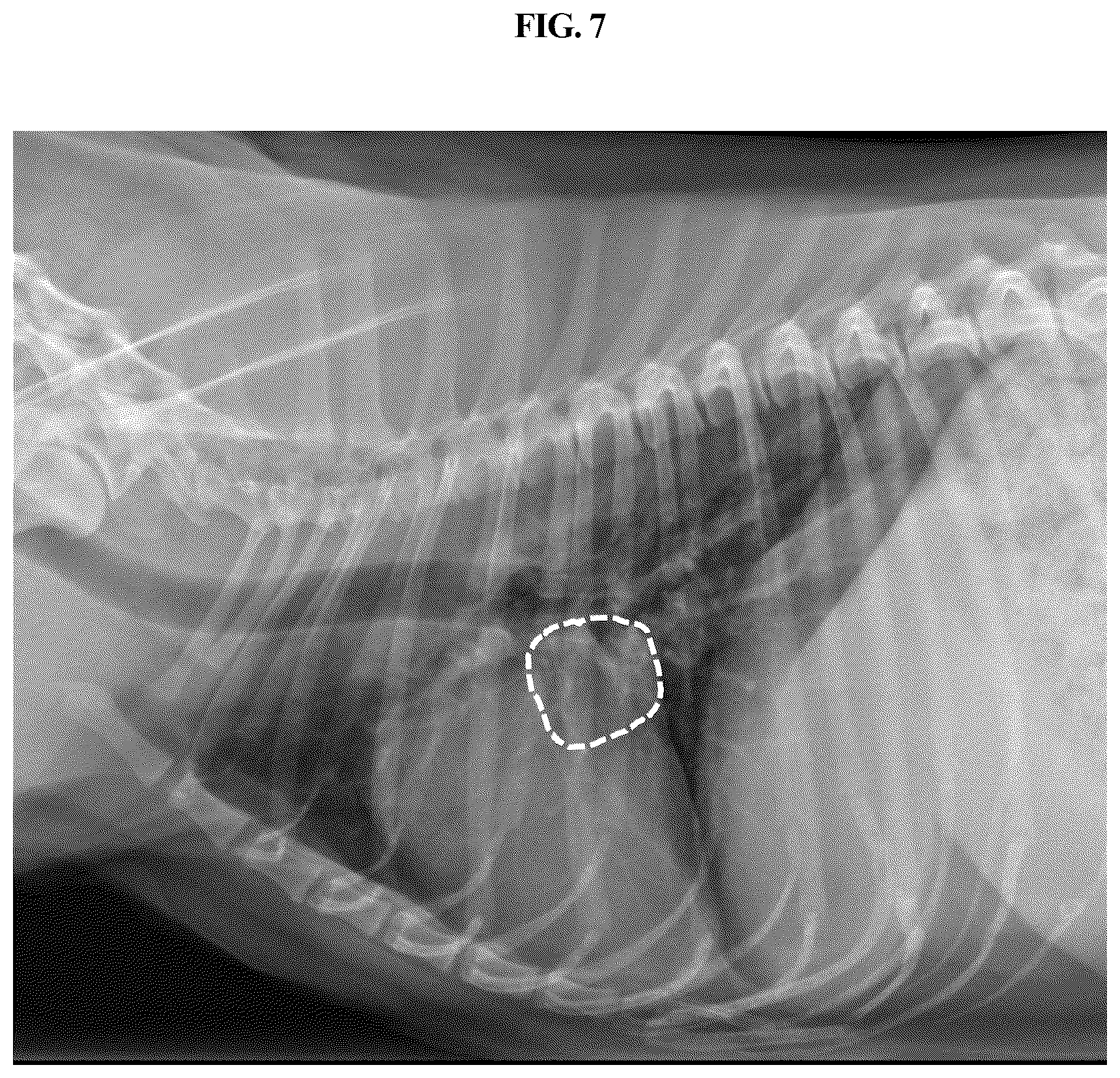 Patent US12307665 Figure 7 – Method and device for quantifying size of tissue of interest of animal by using X-ray image of animal