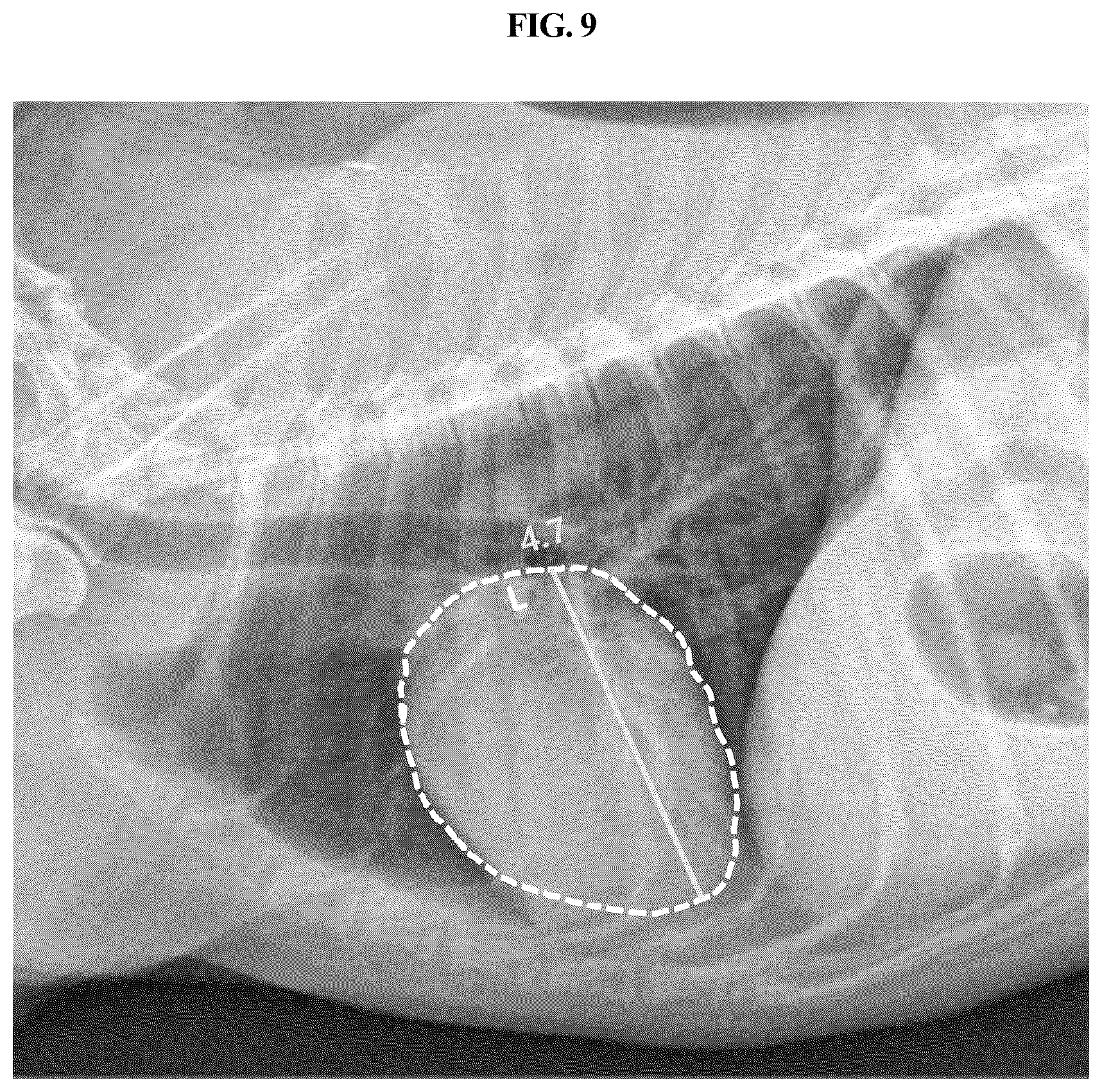 Patent US12307665 Figure 9 – Method and device for quantifying size of tissue of interest of animal by using X-ray image of animal