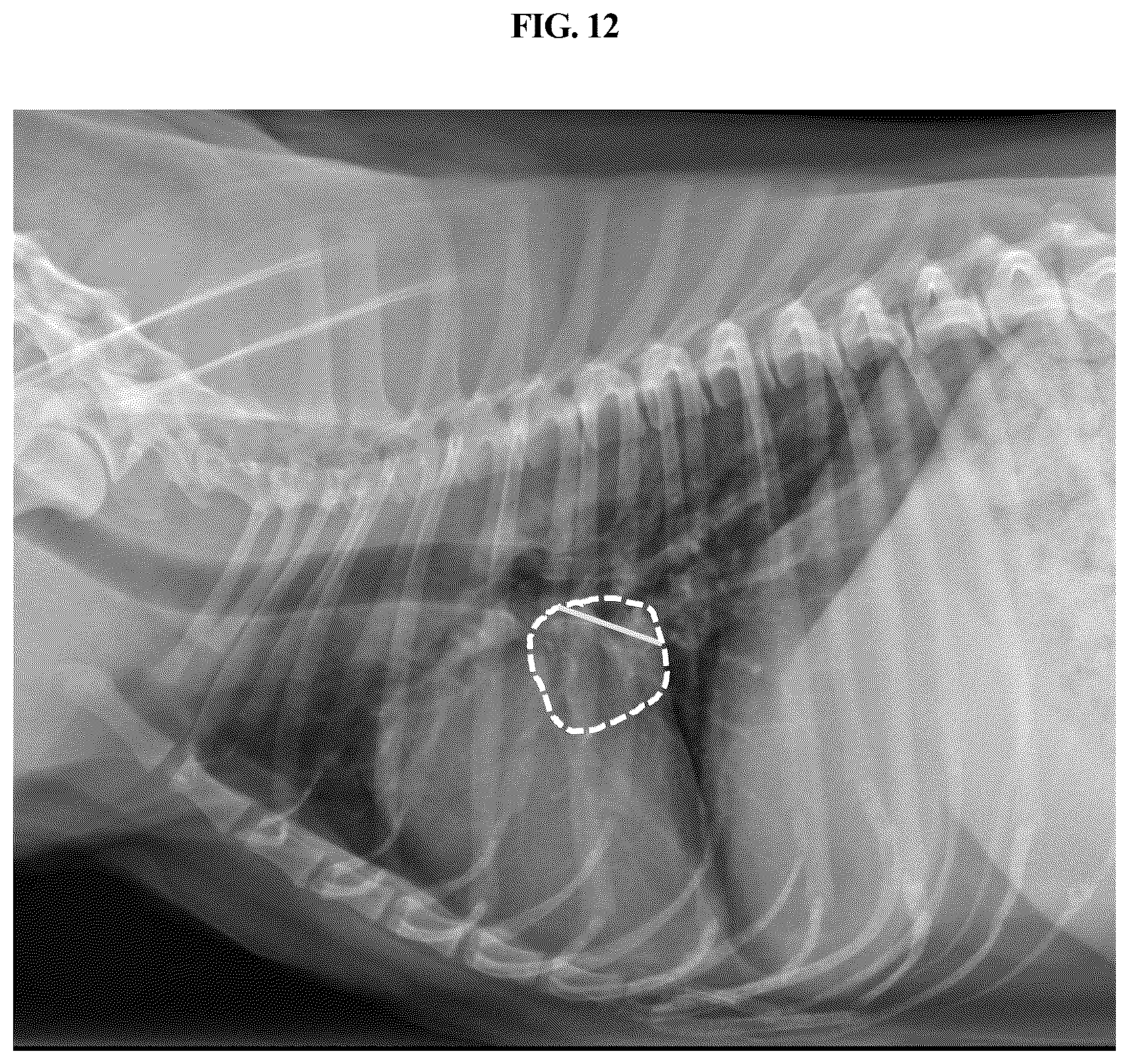 Patent US12307665 Figure 12 – Method and device for quantifying size of tissue of interest of animal by using X-ray image of animal
