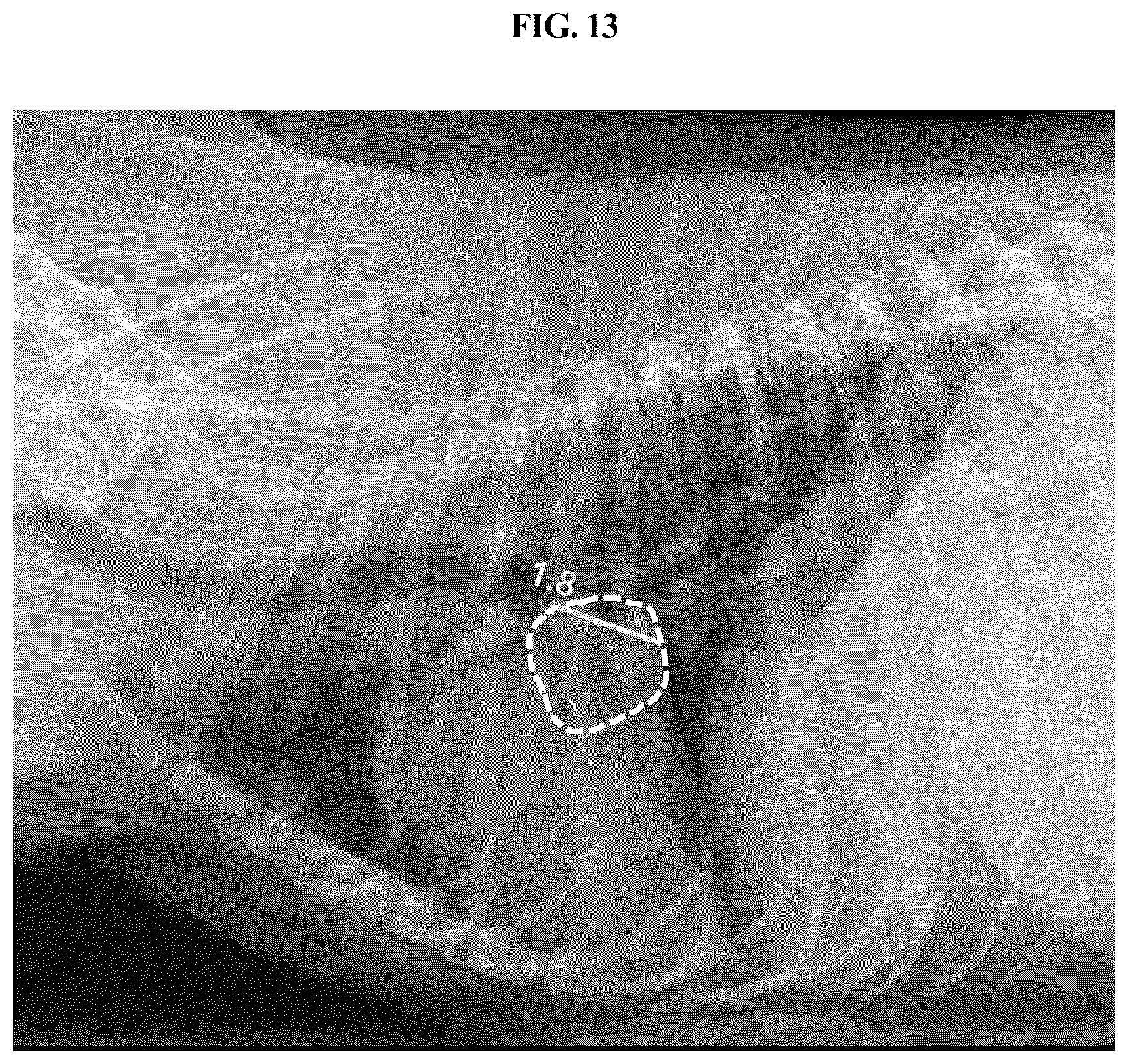 Patent US12307665 Figure 13 – Method and device for quantifying size of tissue of interest of animal by using X-ray image of animal