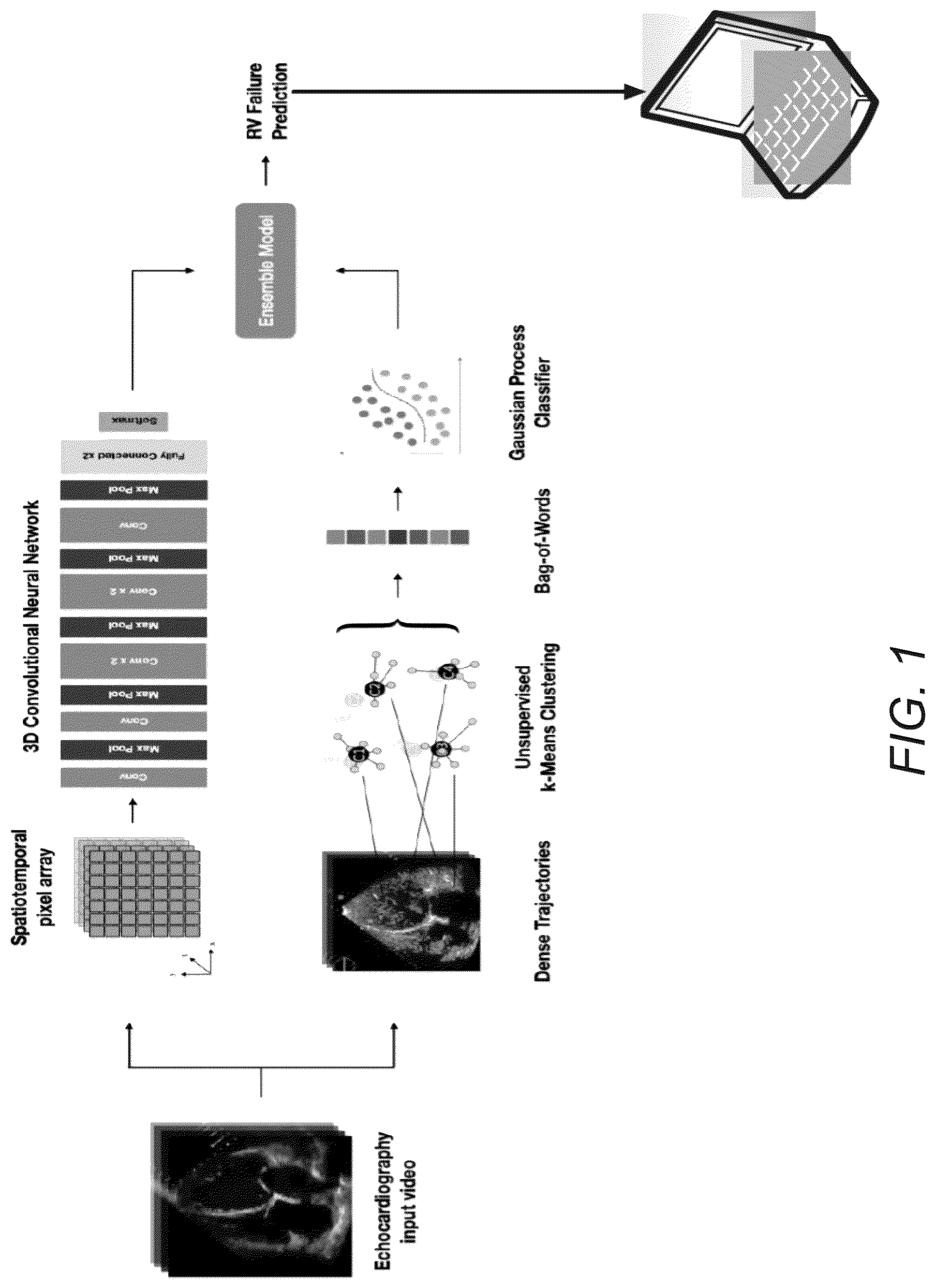Patent US12307666 Figure 1 – Systems and methods for predicting post-operative right ventricular failure using echocardiograms