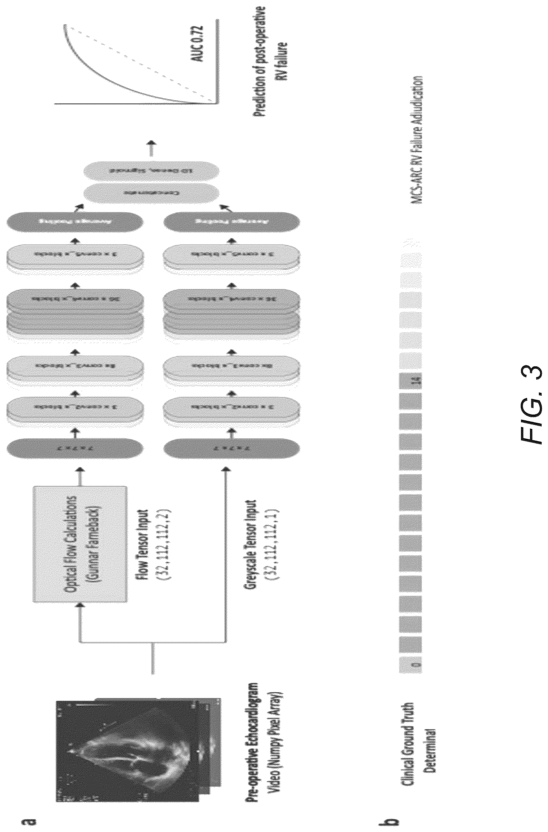 Patent US12307666 Figure 3 – Systems and methods for predicting post-operative right ventricular failure using echocardiograms
