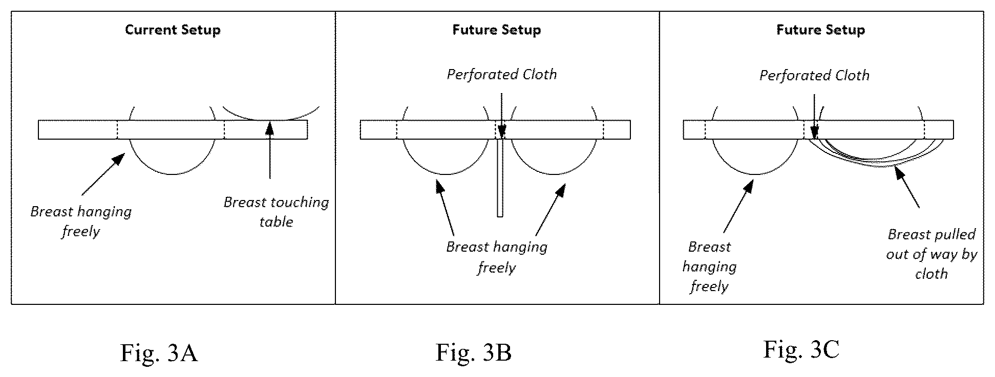 Patent US12307669 Figure 3 – Detection and characterization of cancerous tumors