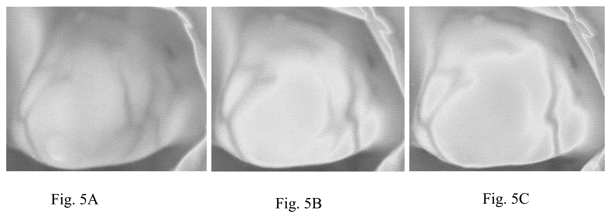 Patent US12307669 Figure 5 – Detection and characterization of cancerous tumors