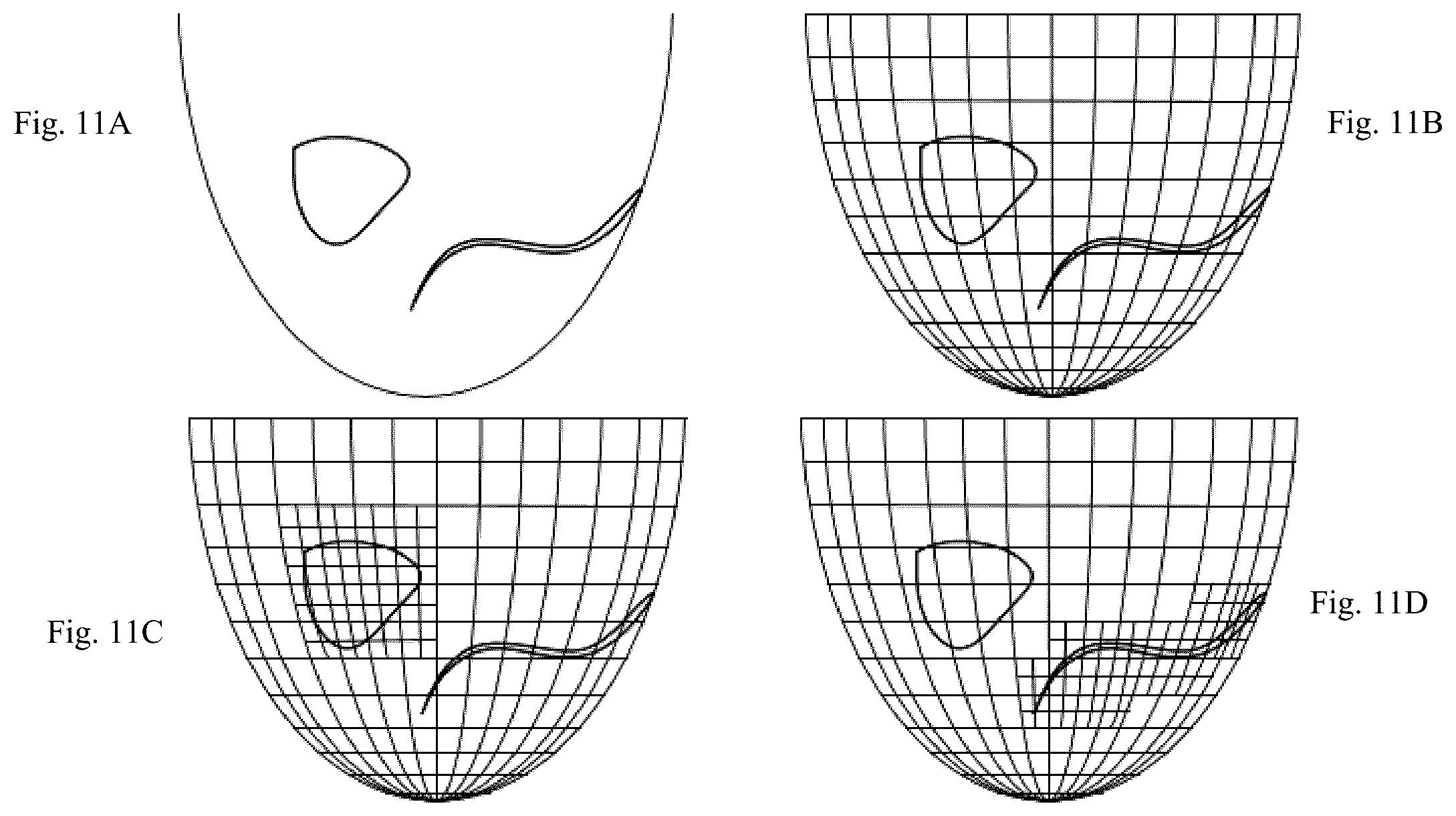 Patent US12307669 Figure 11 – Detection and characterization of cancerous tumors
