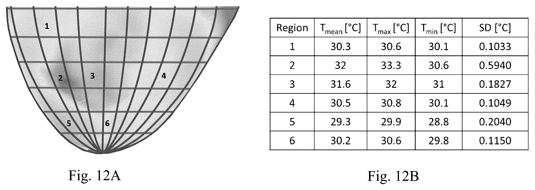Patent US12307669 Figure 12 – Detection and characterization of cancerous tumors