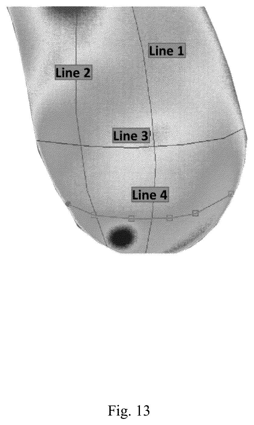 Patent US12307669 Figure 13 – Detection and characterization of cancerous tumors