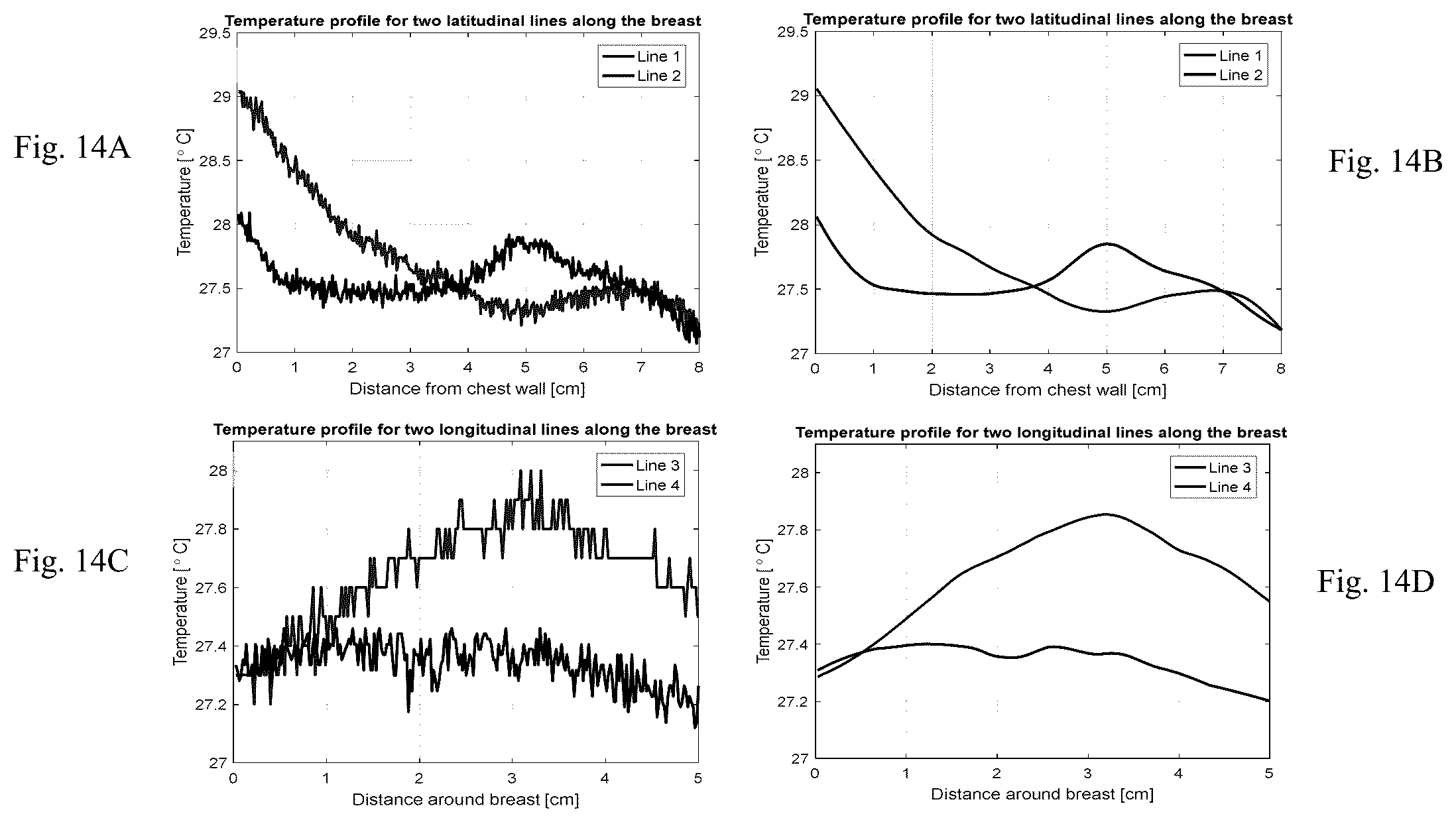 Patent US12307669 Figure 14 – Detection and characterization of cancerous tumors