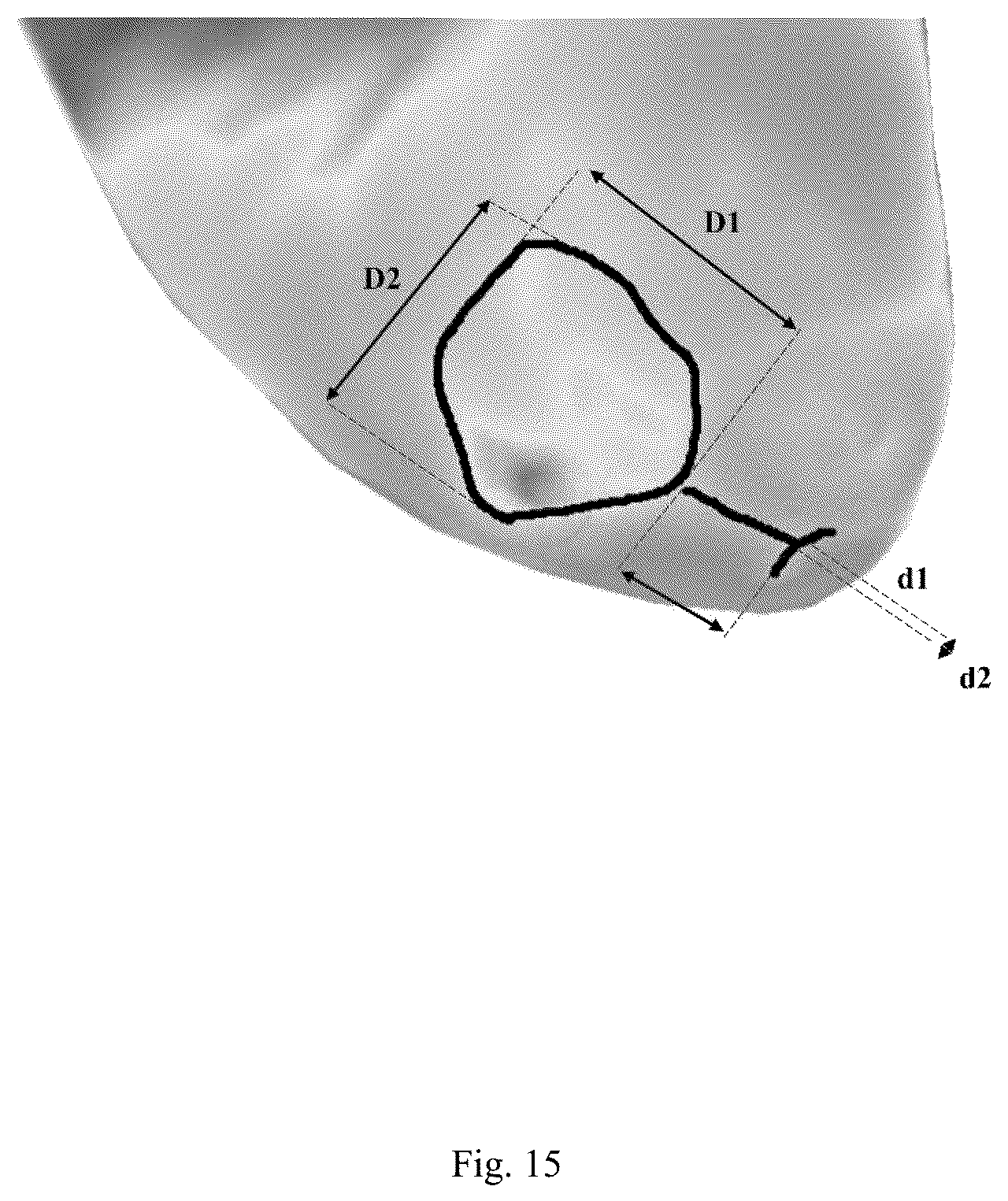 Patent US12307669 Figure 15 – Detection and characterization of cancerous tumors