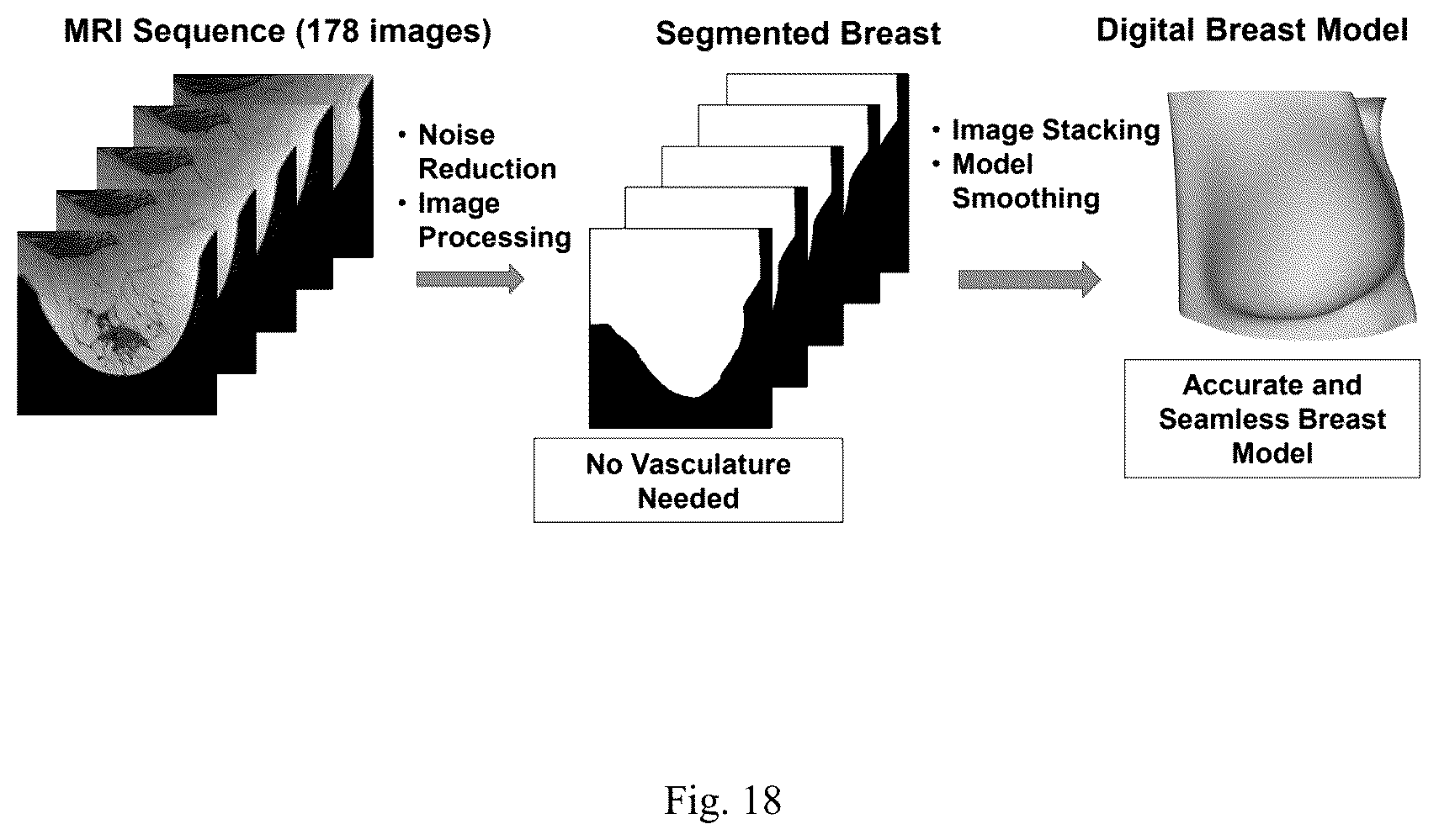 Patent US12307669 Figure 18 – Detection and characterization of cancerous tumors