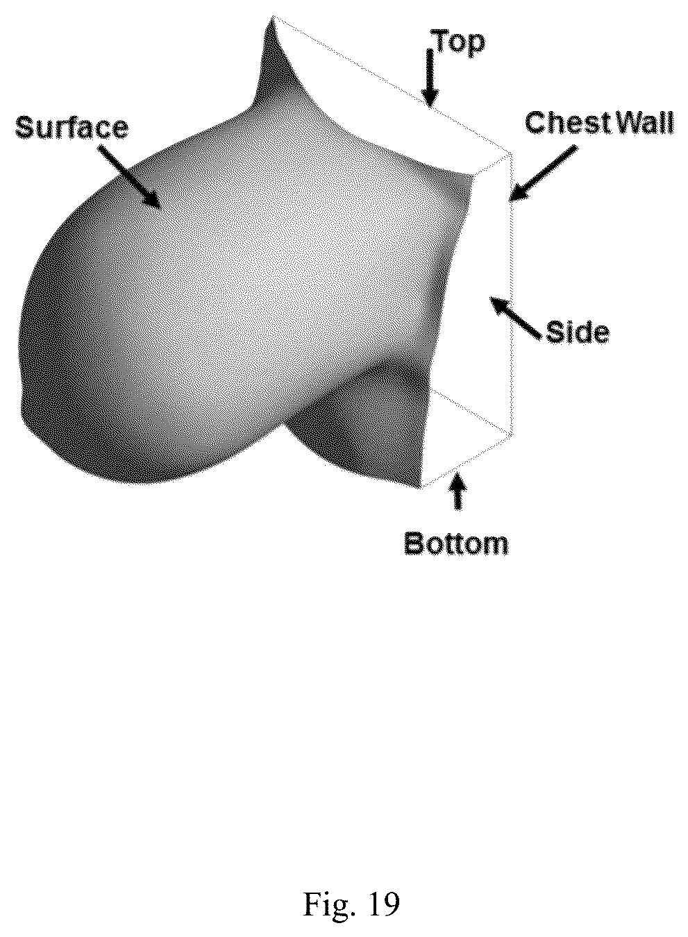 Patent US12307669 Figure 19 – Detection and characterization of cancerous tumors