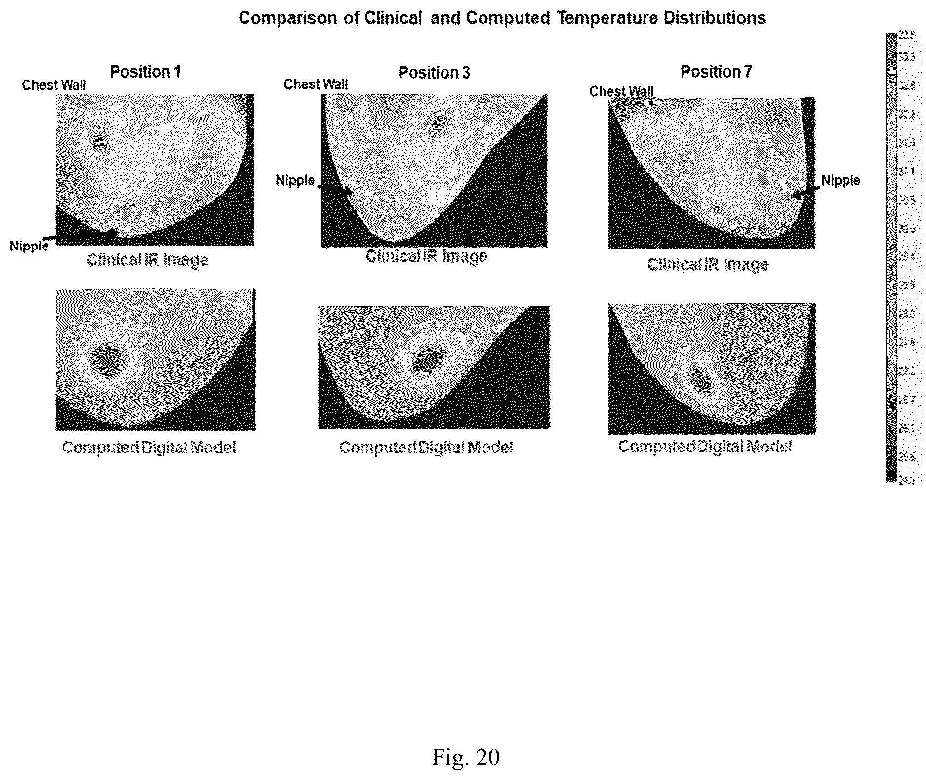 Patent US12307669 Figure 20 – Detection and characterization of cancerous tumors