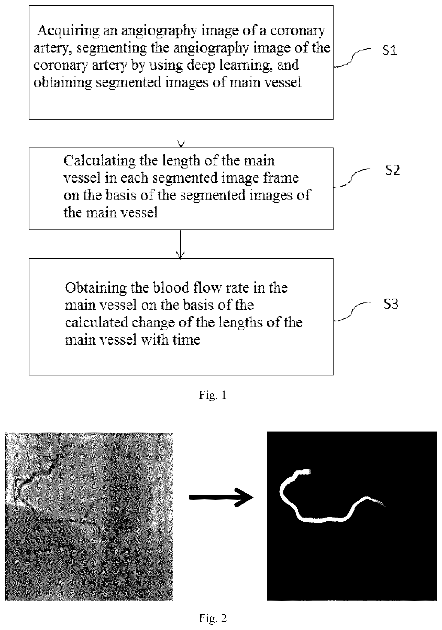 Patent US12307672 Figure 1 – Method and apparatus for calculating blood flow rate in coronary artery, and electronic device
