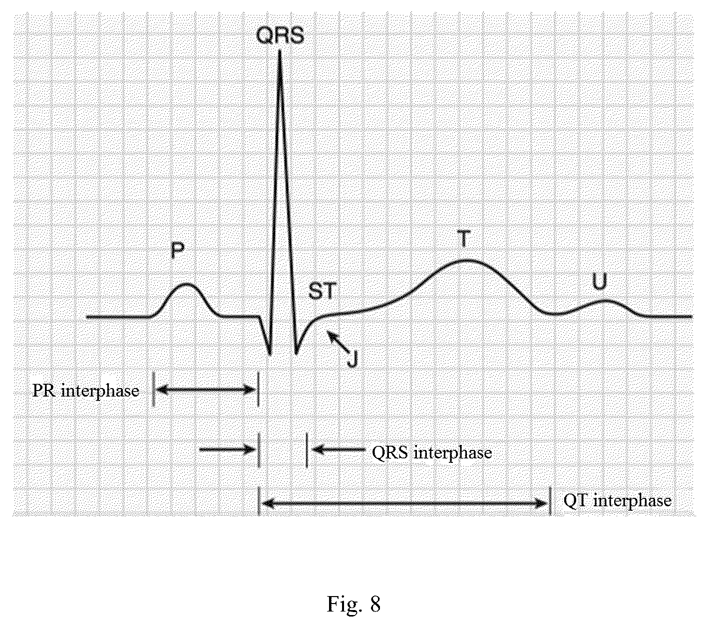 Patent US12307672 Figure 5 – Method and apparatus for calculating blood flow rate in coronary artery, and electronic device