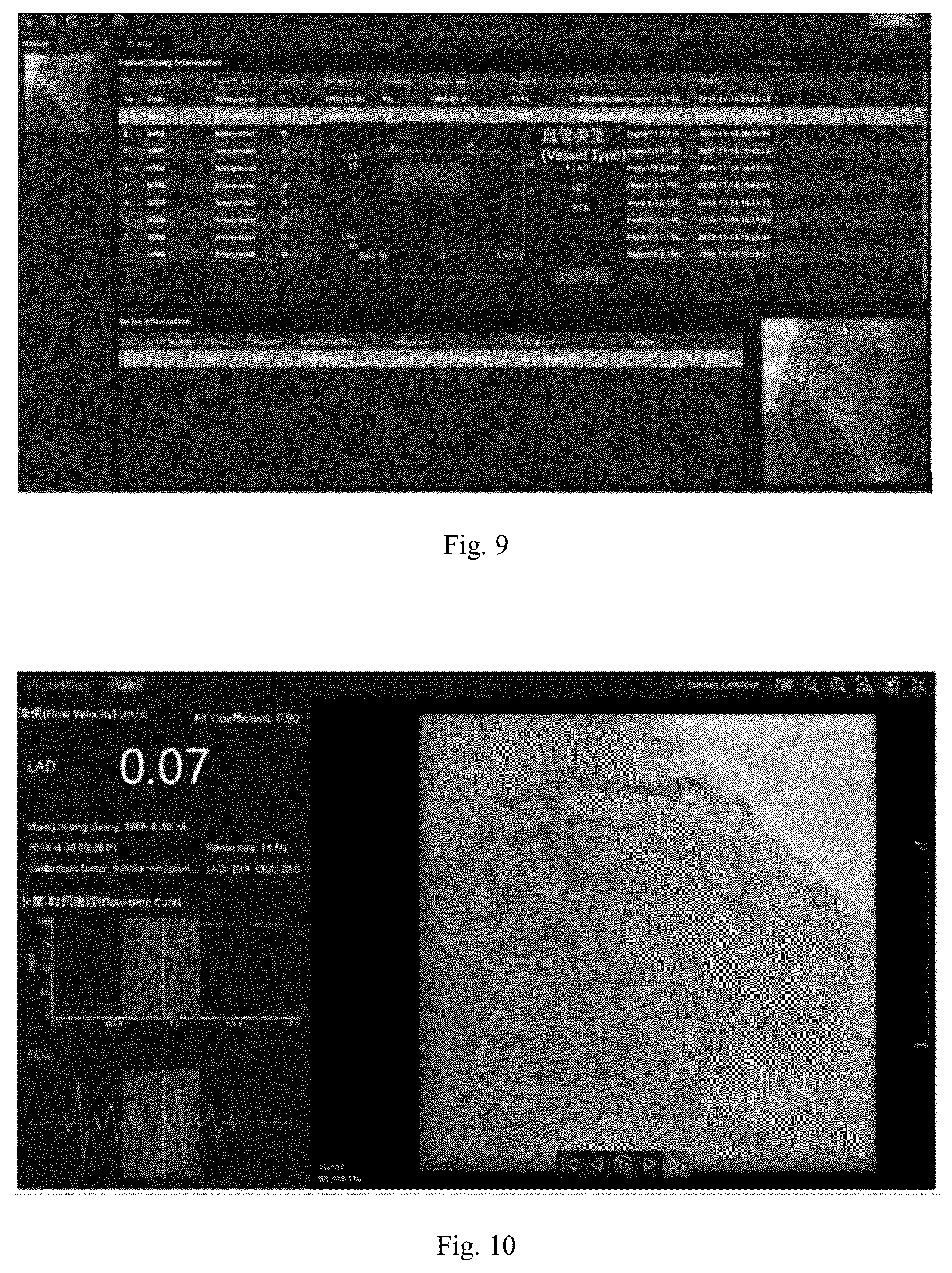 Patent US12307672 Figure 6 – Method and apparatus for calculating blood flow rate in coronary artery, and electronic device