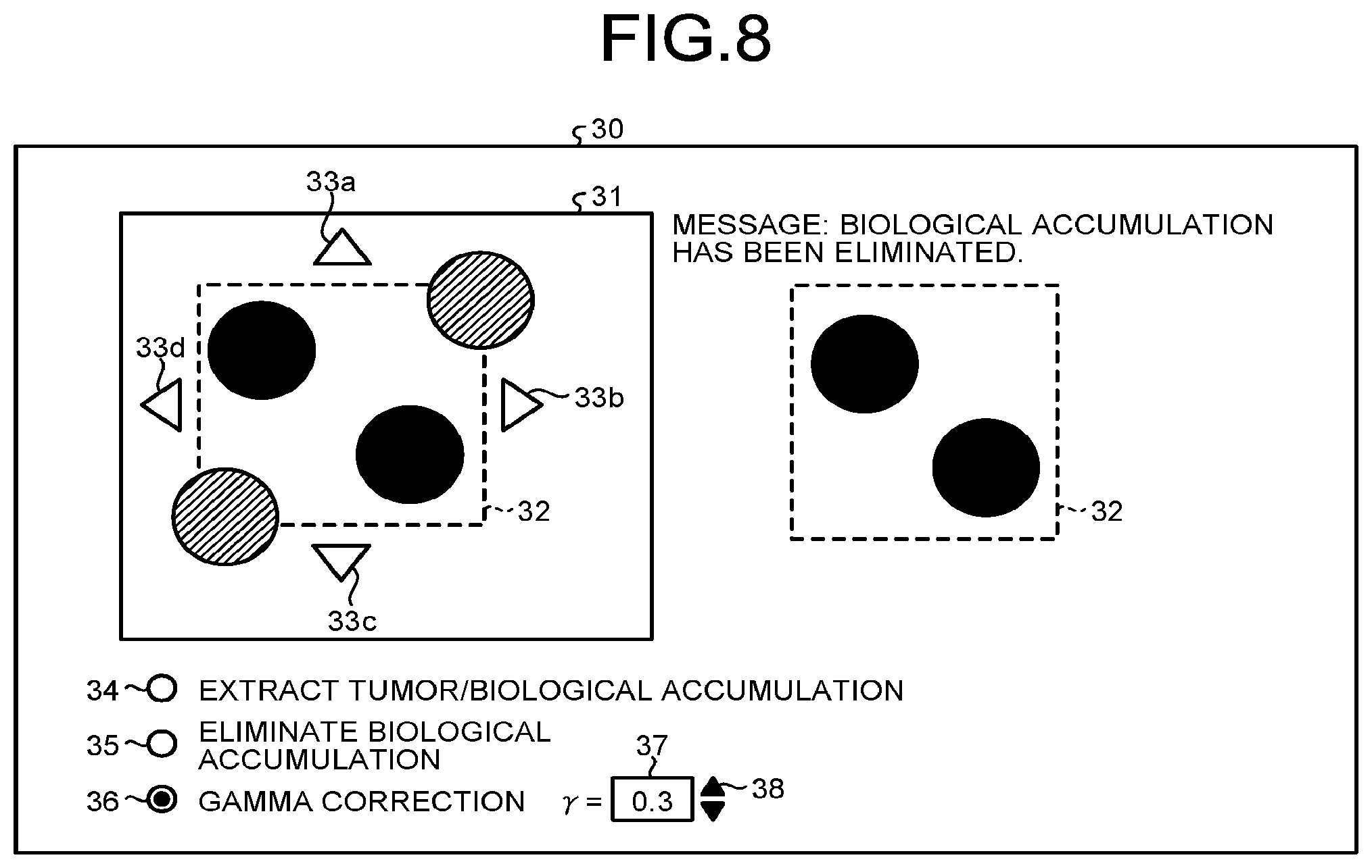 Patent US12307673 Figure 5 – Nuclear medicine diagnosis apparatus, data processing method, and computer program product