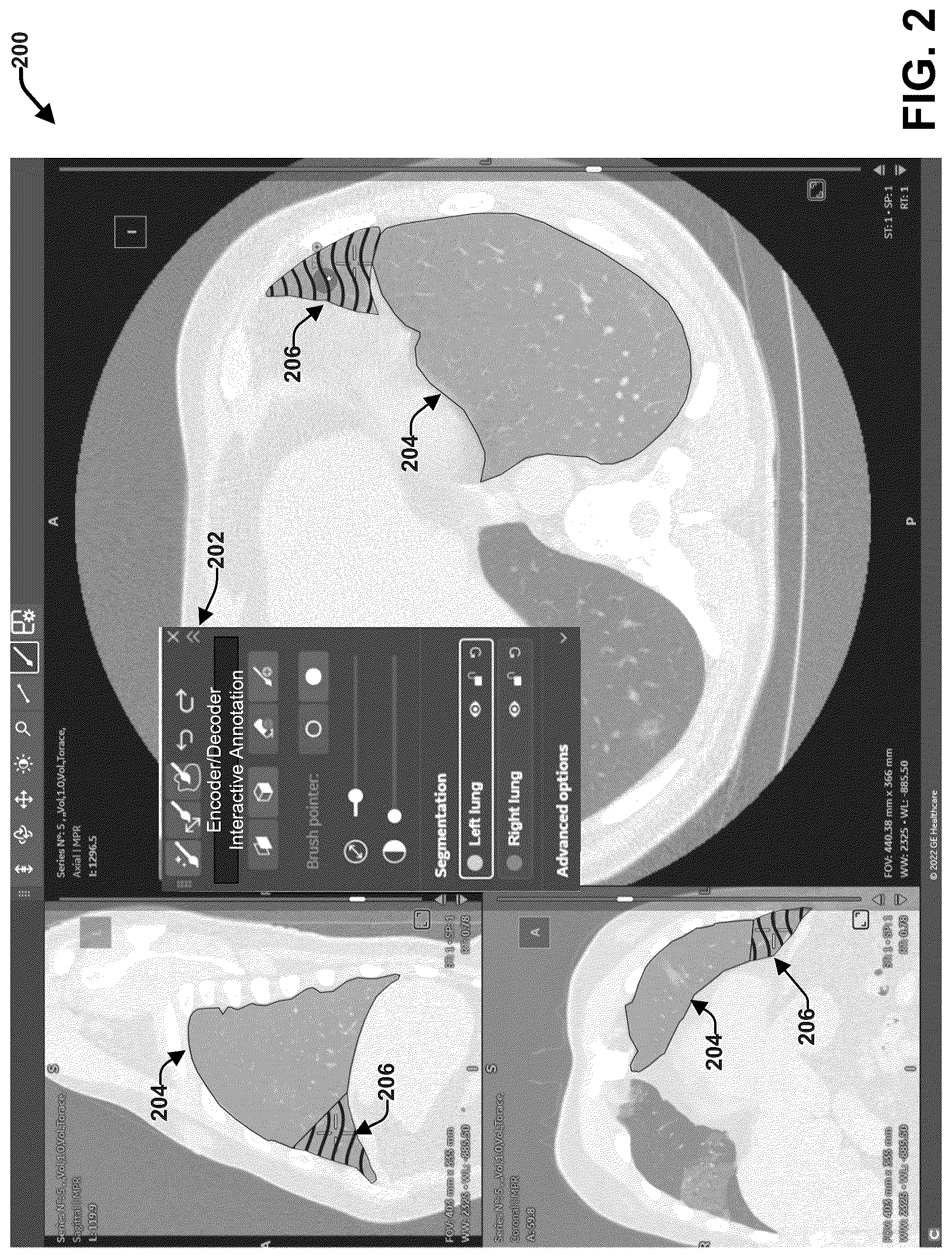 Patent US12307674 Figure 2 – Low latency interactive segmentation of medical images within a web-based deployment architecture