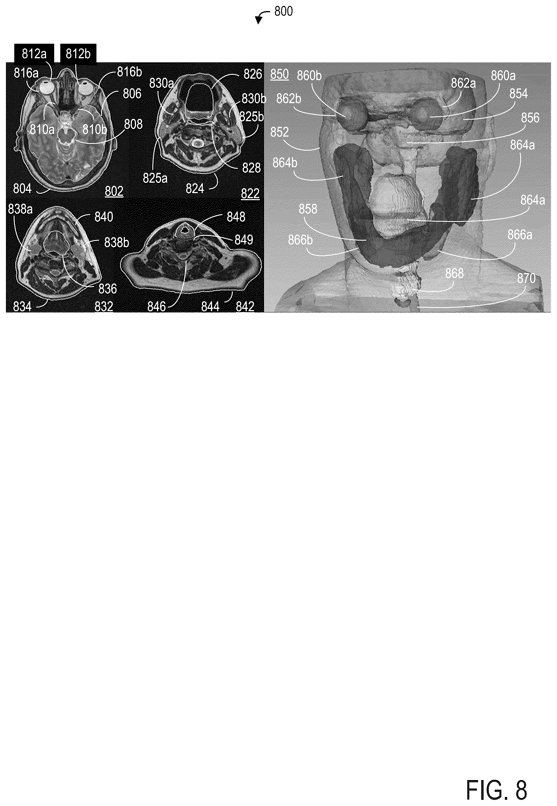 Patent US12307675 Figure 9 – Systems and methods for segmenting objects in medical images
