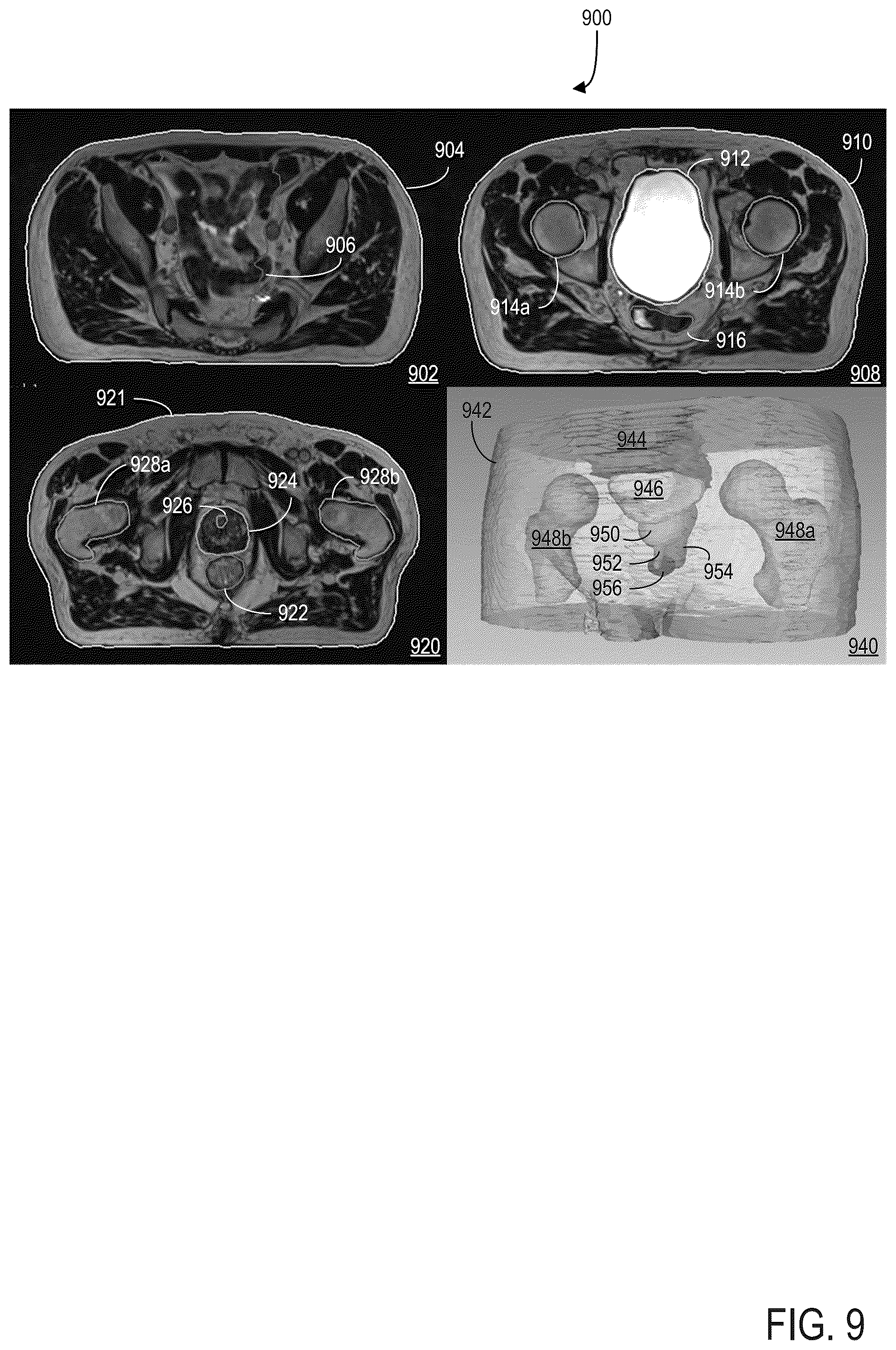 Patent US12307675 Figure 10 – Systems and methods for segmenting objects in medical images
