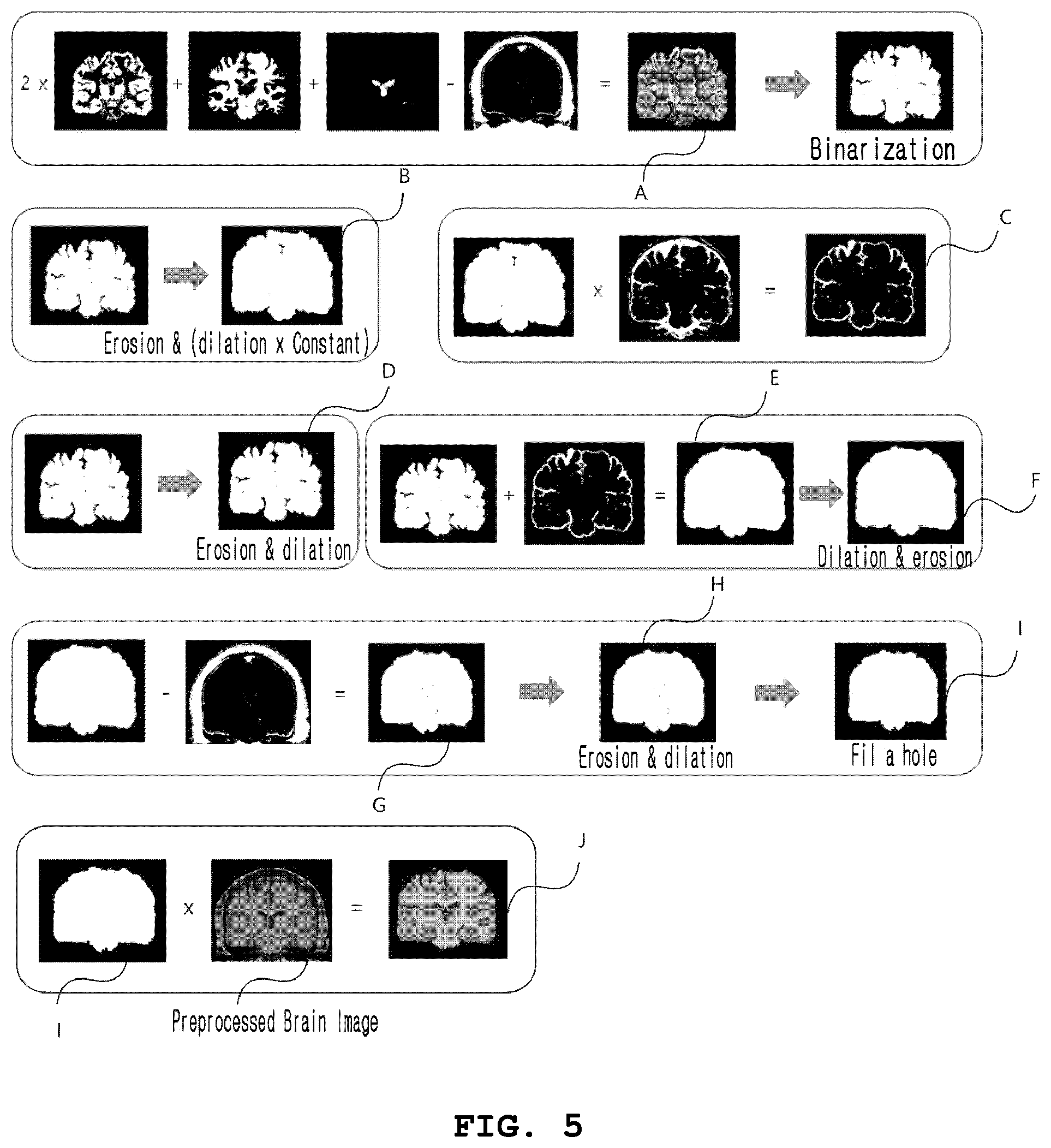 Patent US12307678 Figure 4 – System and method for segmentating brain in MRI images