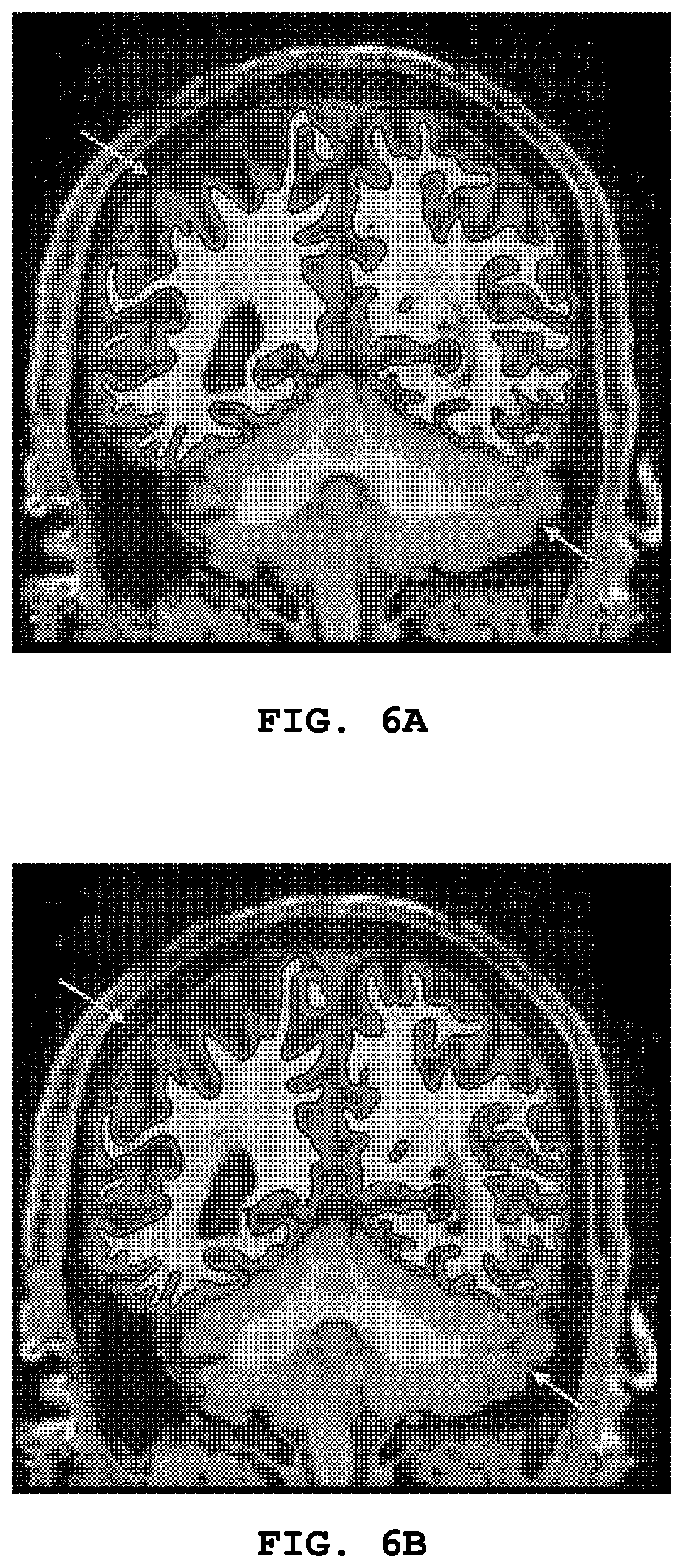 Patent US12307678 Figure 5 – System and method for segmentating brain in MRI images