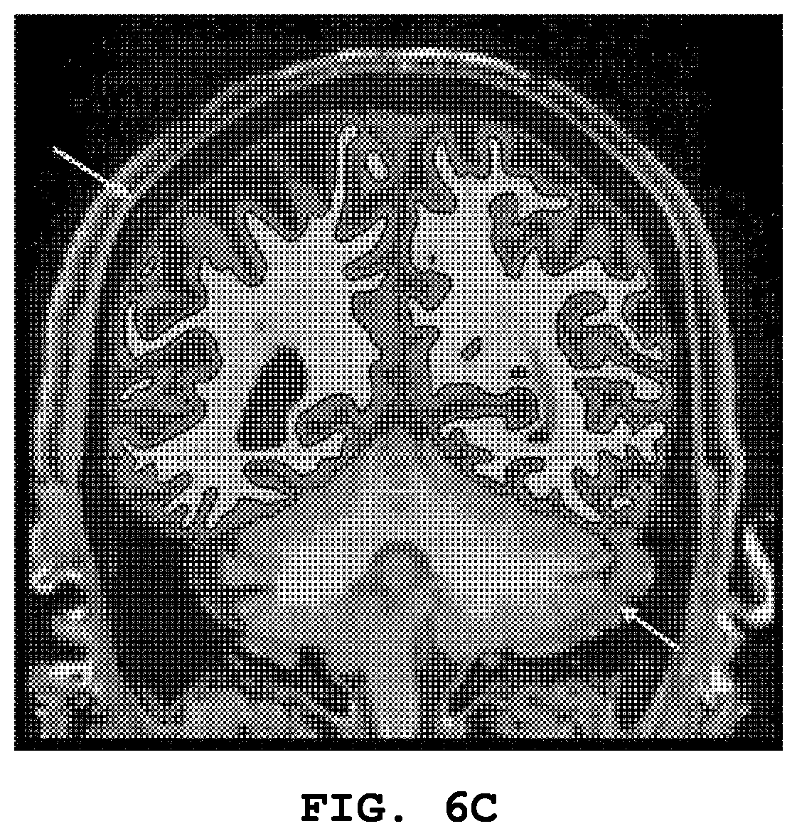 Patent US12307678 Figure 6 – System and method for segmentating brain in MRI images