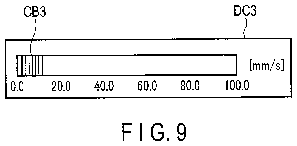 Patent US12307688 Figure 5 – Analysis apparatus and ultrasound diagnosis apparatus